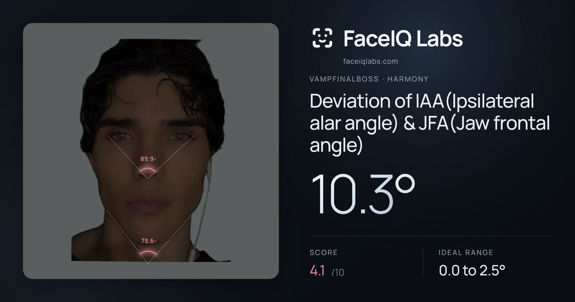 Vampfinalboss Deviation of IAA(Ipsilateral alar angle) & JFA(Jaw frontal angle): 10.3°, drawn on the photo