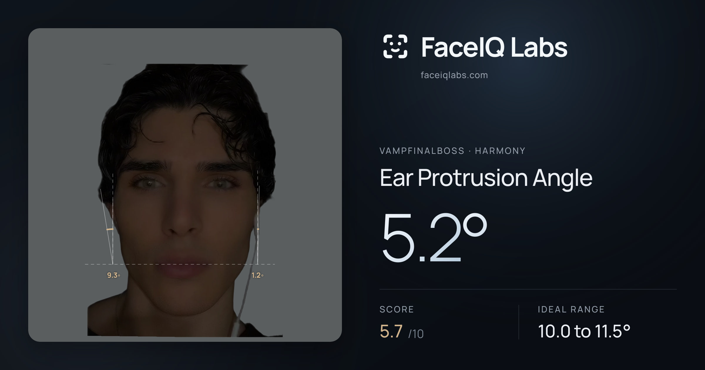 Vampfinalboss Ear Protrusion Angle: 5.2°, drawn on the photo