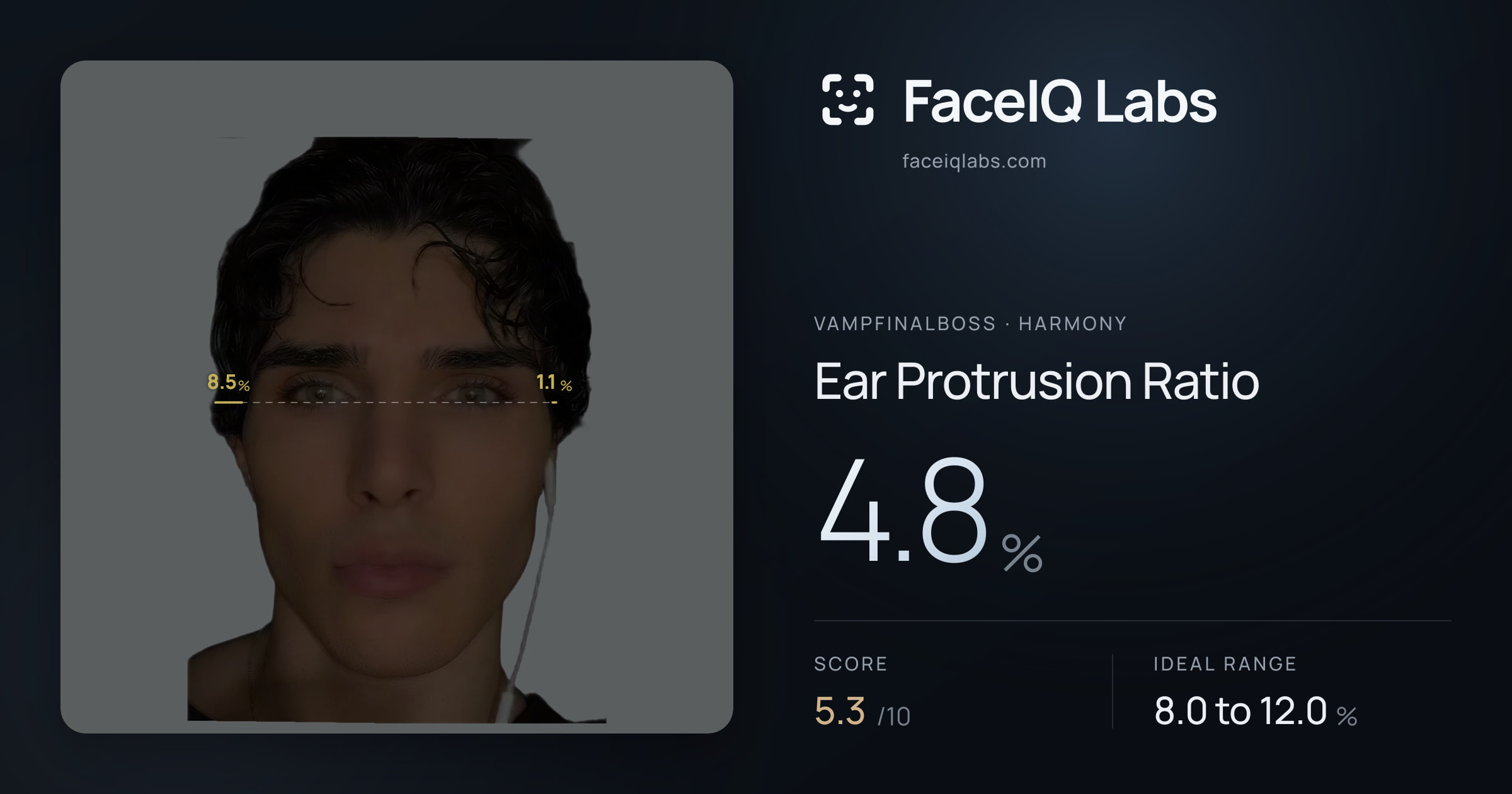 Vampfinalboss Ear Protrusion Ratio: 4.8%, drawn on the photo