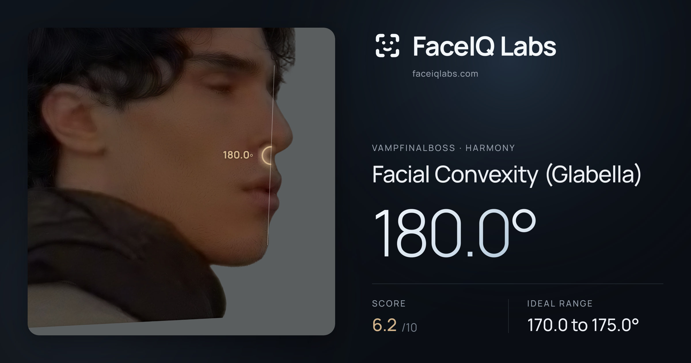 Vampfinalboss Facial Convexity (Glabella): 180.0°, drawn on the photo