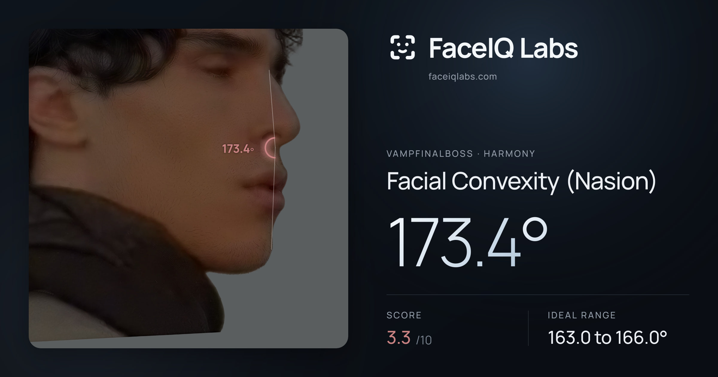 Vampfinalboss Facial Convexity (Nasion): 173.4°, drawn on the photo