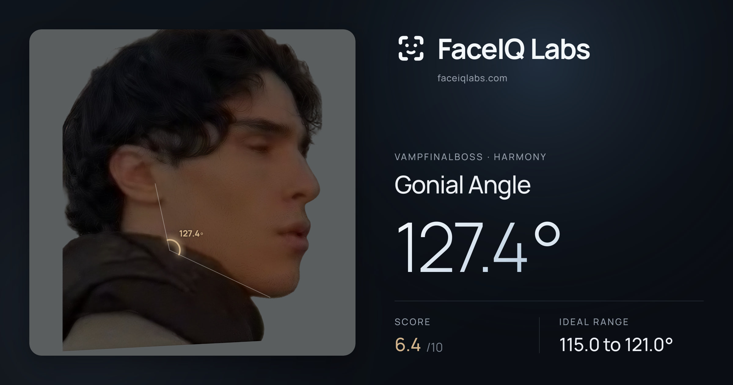 Vampfinalboss Gonial Angle: 127.4°, drawn on the photo