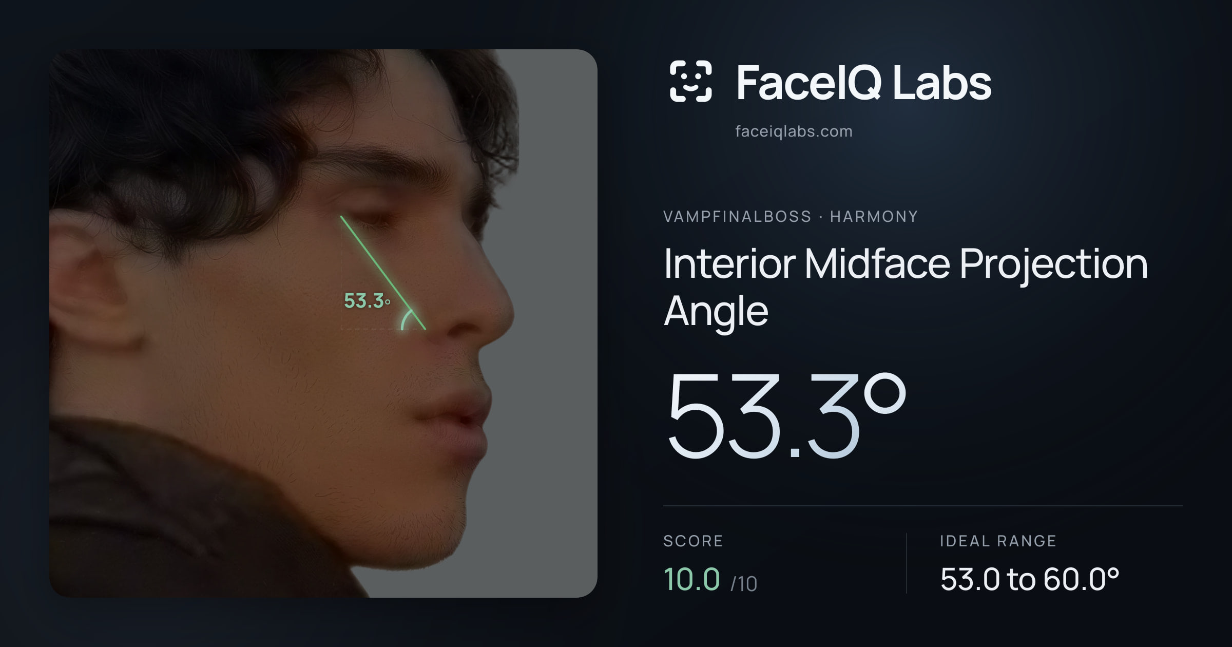 Vampfinalboss Interior Midface Projection Angle: 53.3°, drawn on the photo