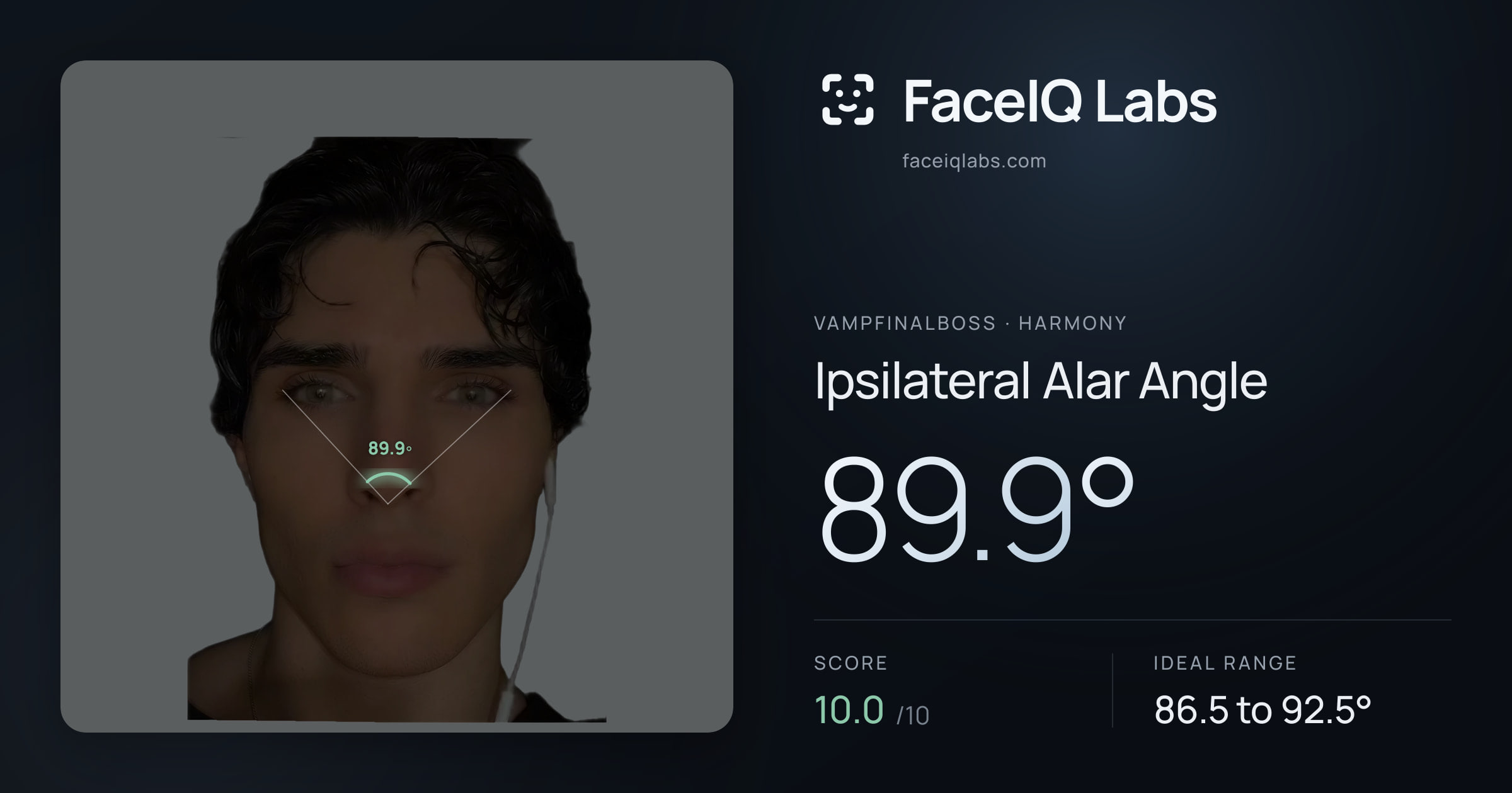Vampfinalboss Ipsilateral Alar Angle: 89.9°, drawn on the photo