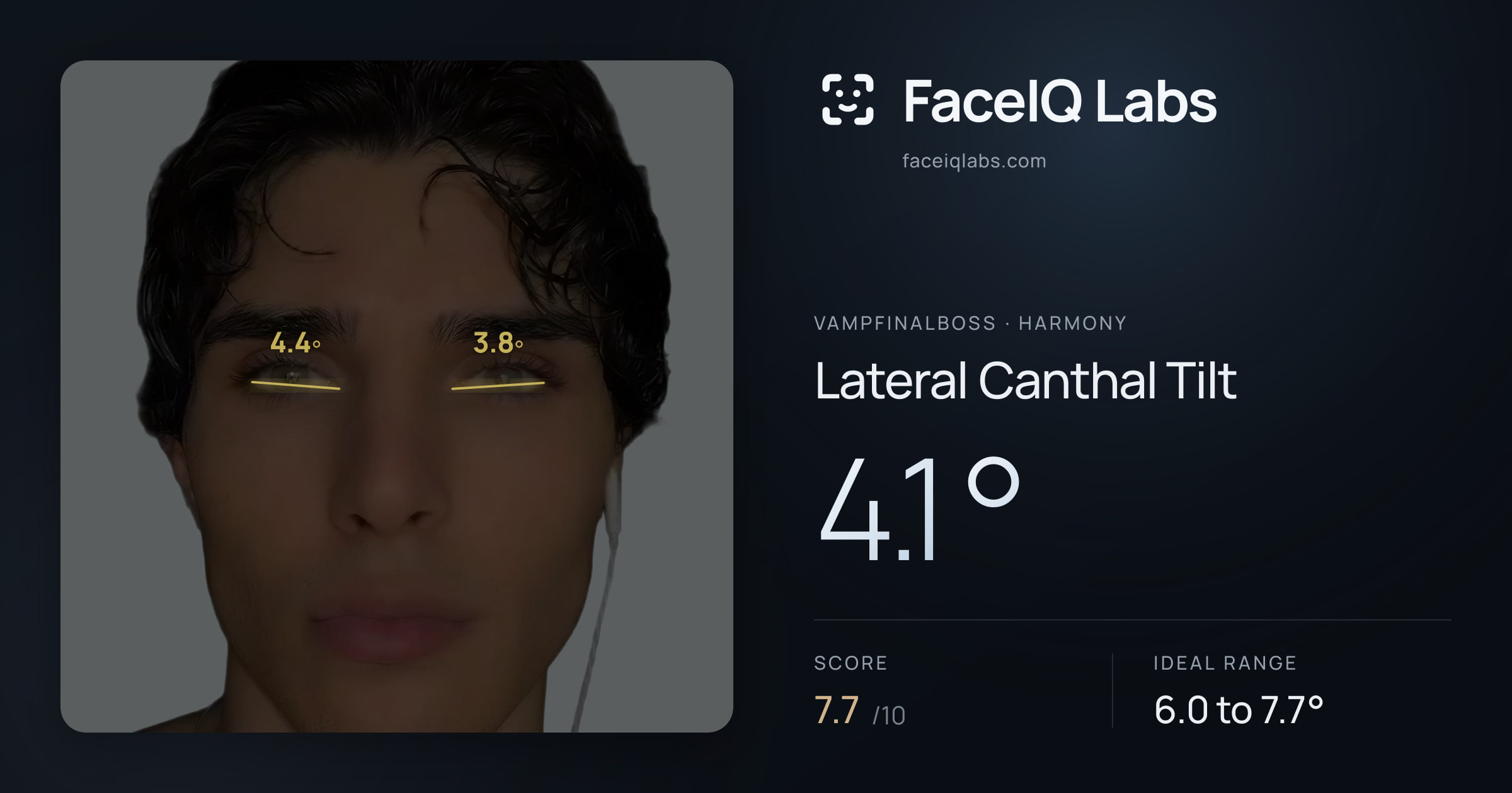 Vampfinalboss Lateral Canthal Tilt: 4.1°, drawn on the photo