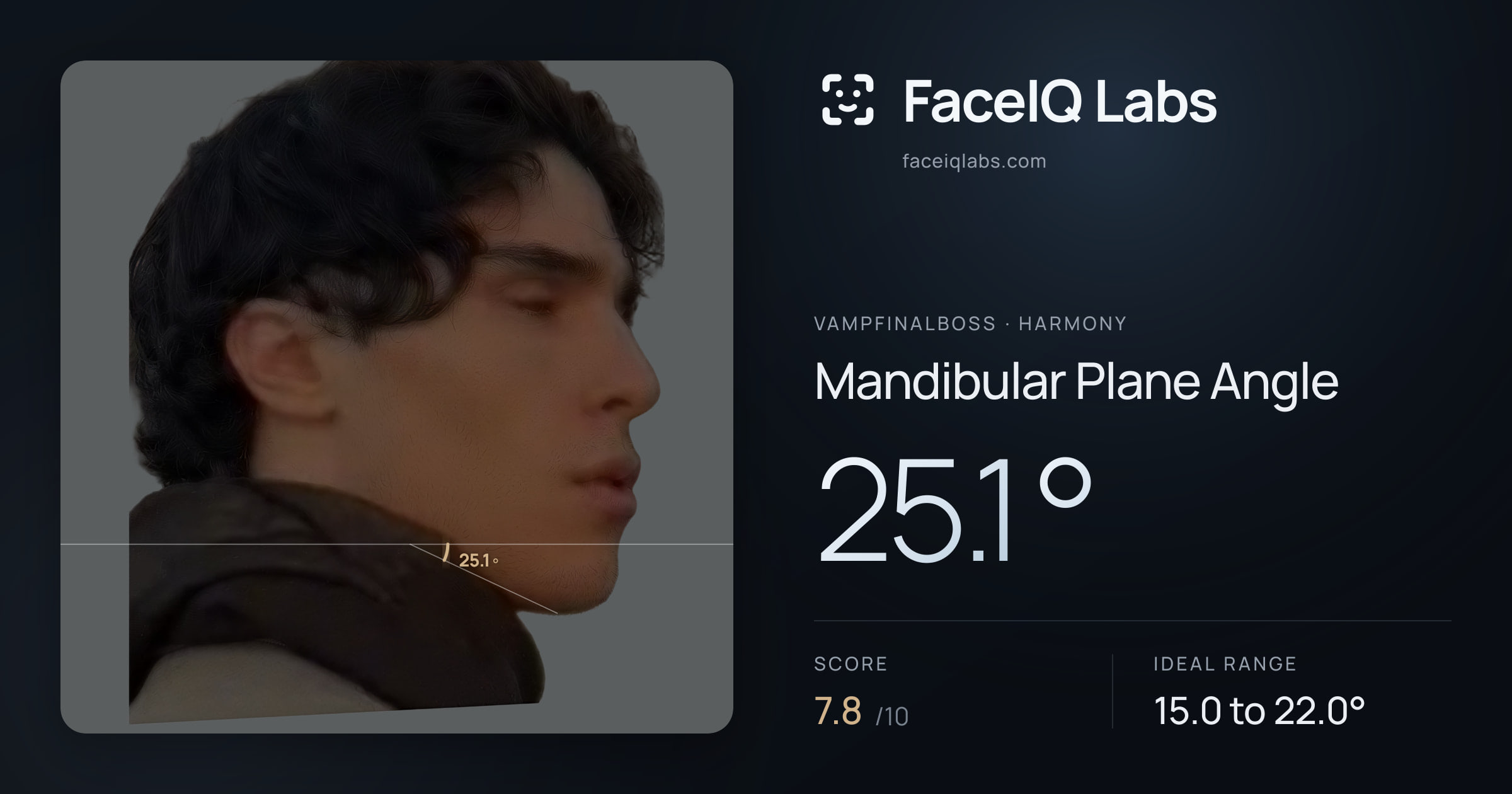 Vampfinalboss Mandibular Plane Angle: 25.1°, drawn on the photo