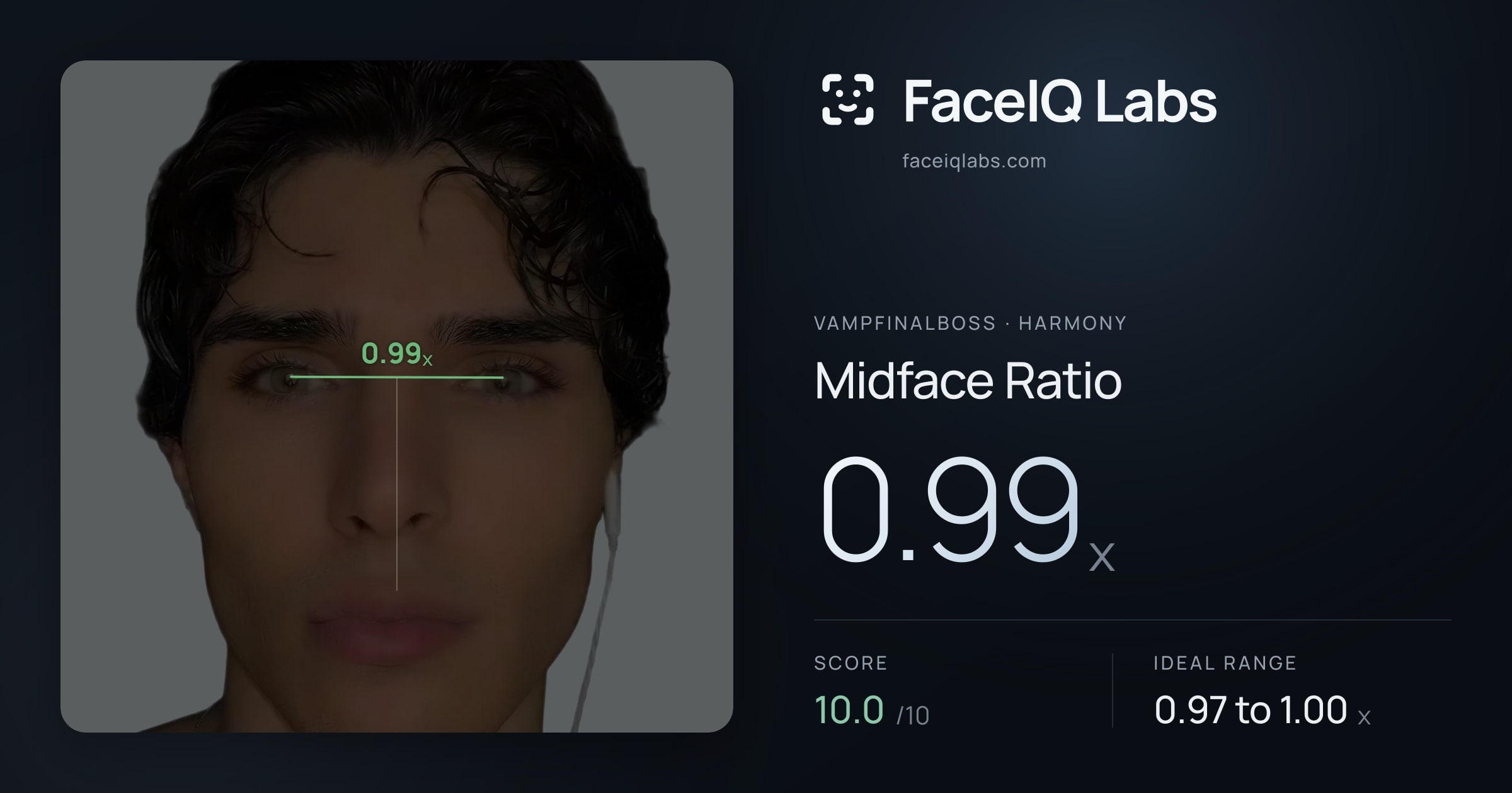 Vampfinalboss Midface Ratio: 0.99x, drawn on the photo