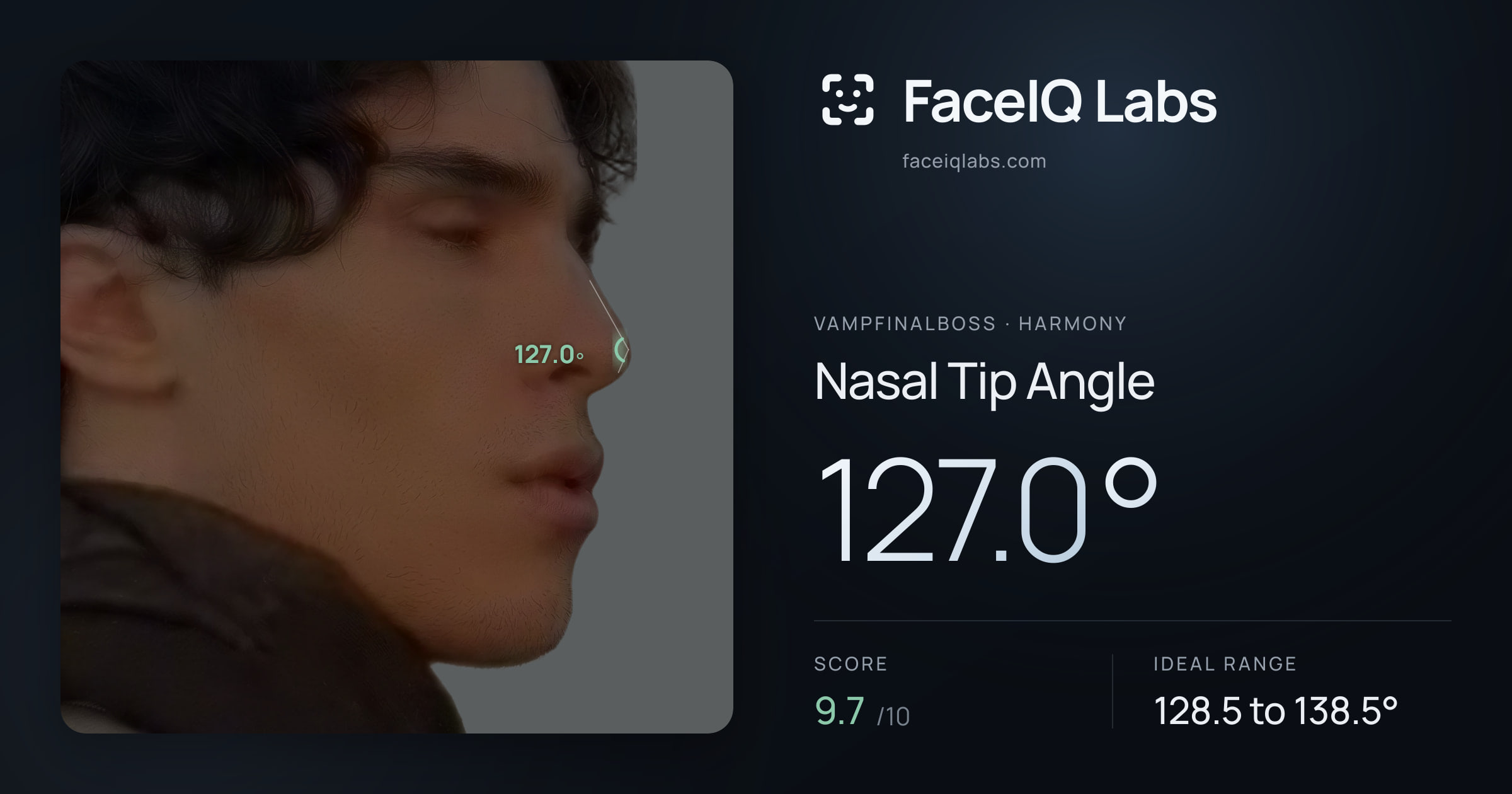 Vampfinalboss Nasal Tip Angle: 127.0°, drawn on the photo
