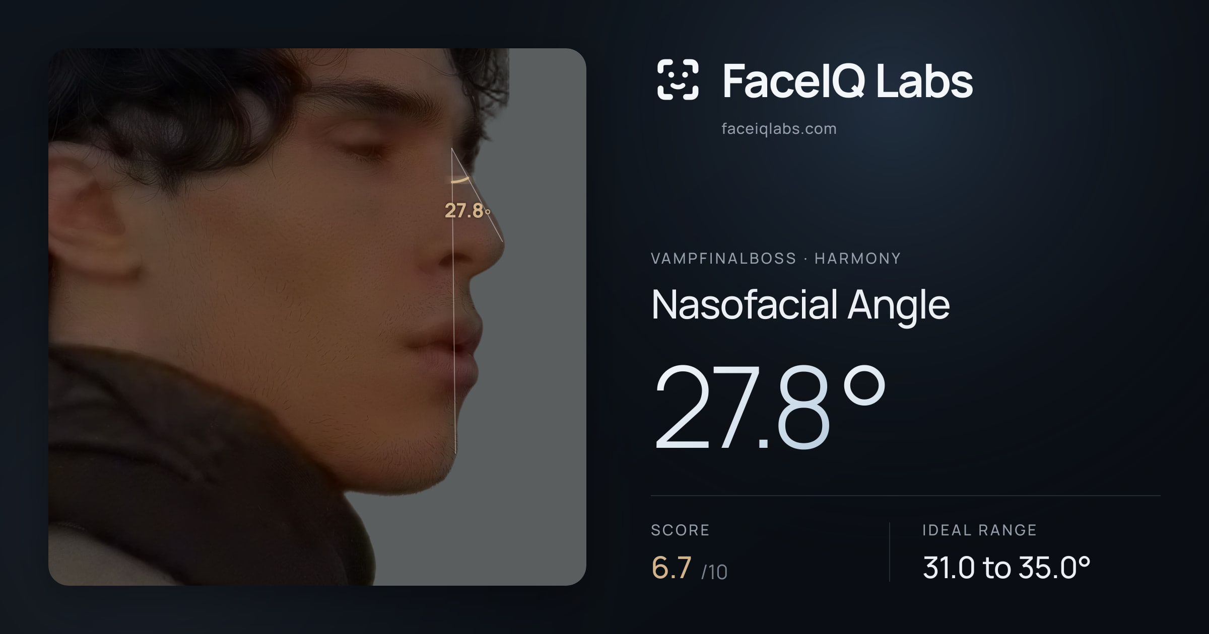 Vampfinalboss Nasofacial Angle: 27.8°, drawn on the photo