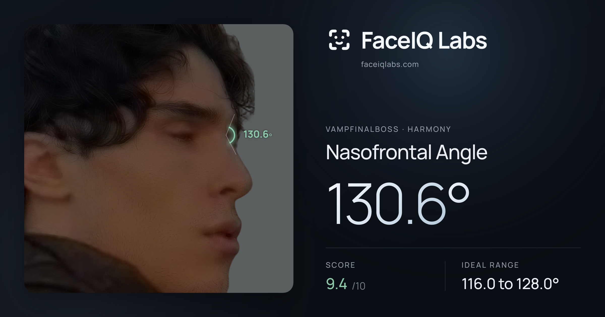 Vampfinalboss Nasofrontal Angle: 130.6°, drawn on the photo
