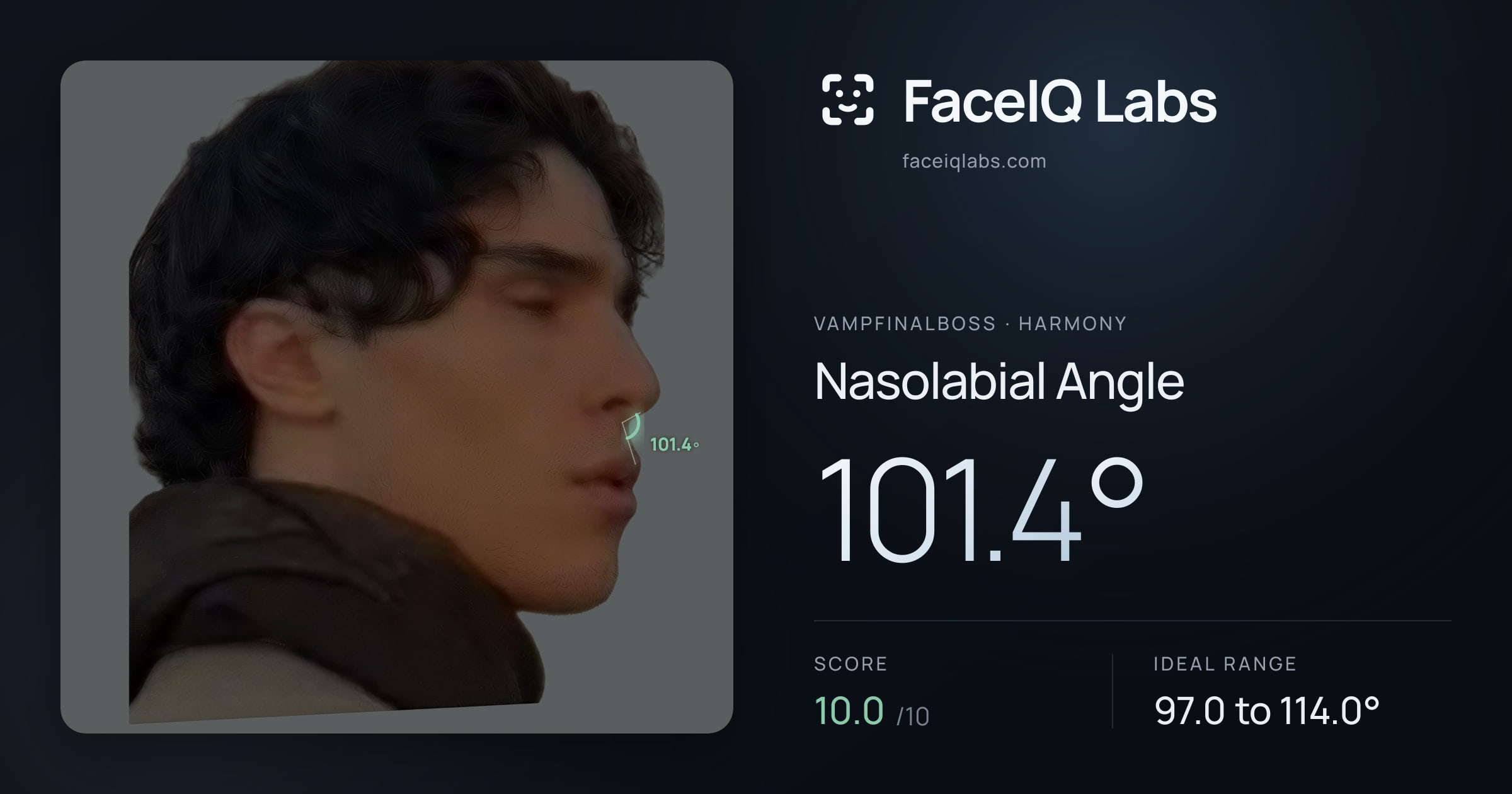 Vampfinalboss Nasolabial Angle: 101.4°, drawn on the photo