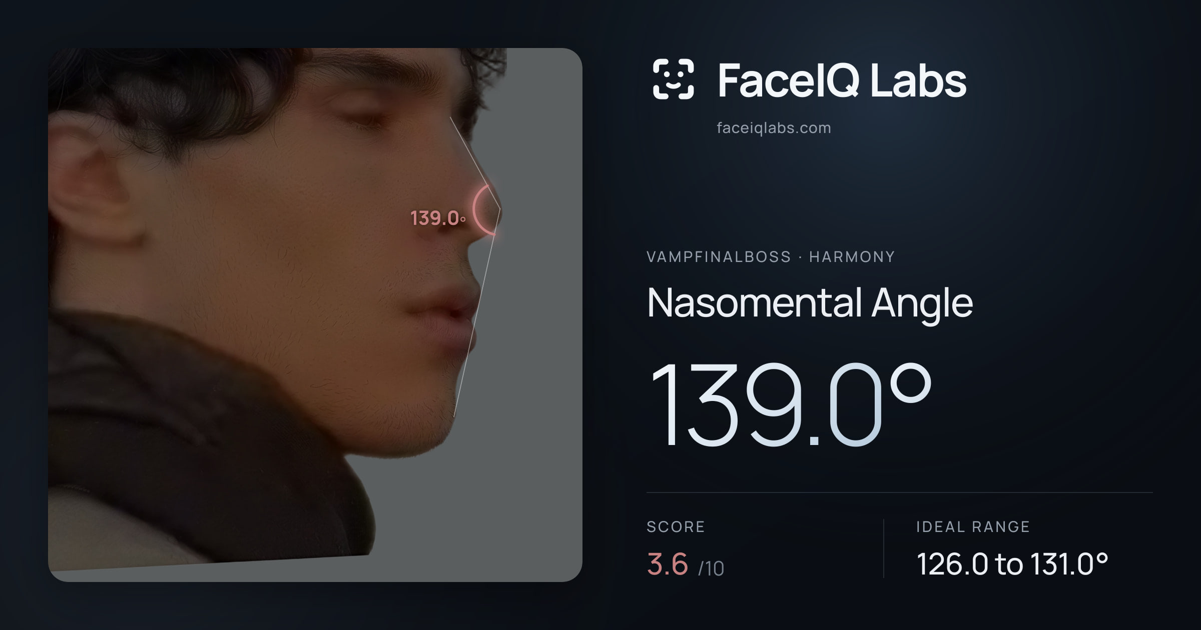 Vampfinalboss Nasomental Angle: 139.0°, drawn on the photo