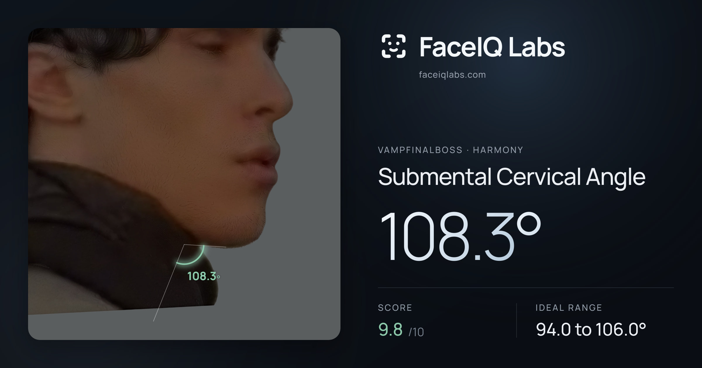 Vampfinalboss Submental Cervical Angle: 108.3°, drawn on the photo