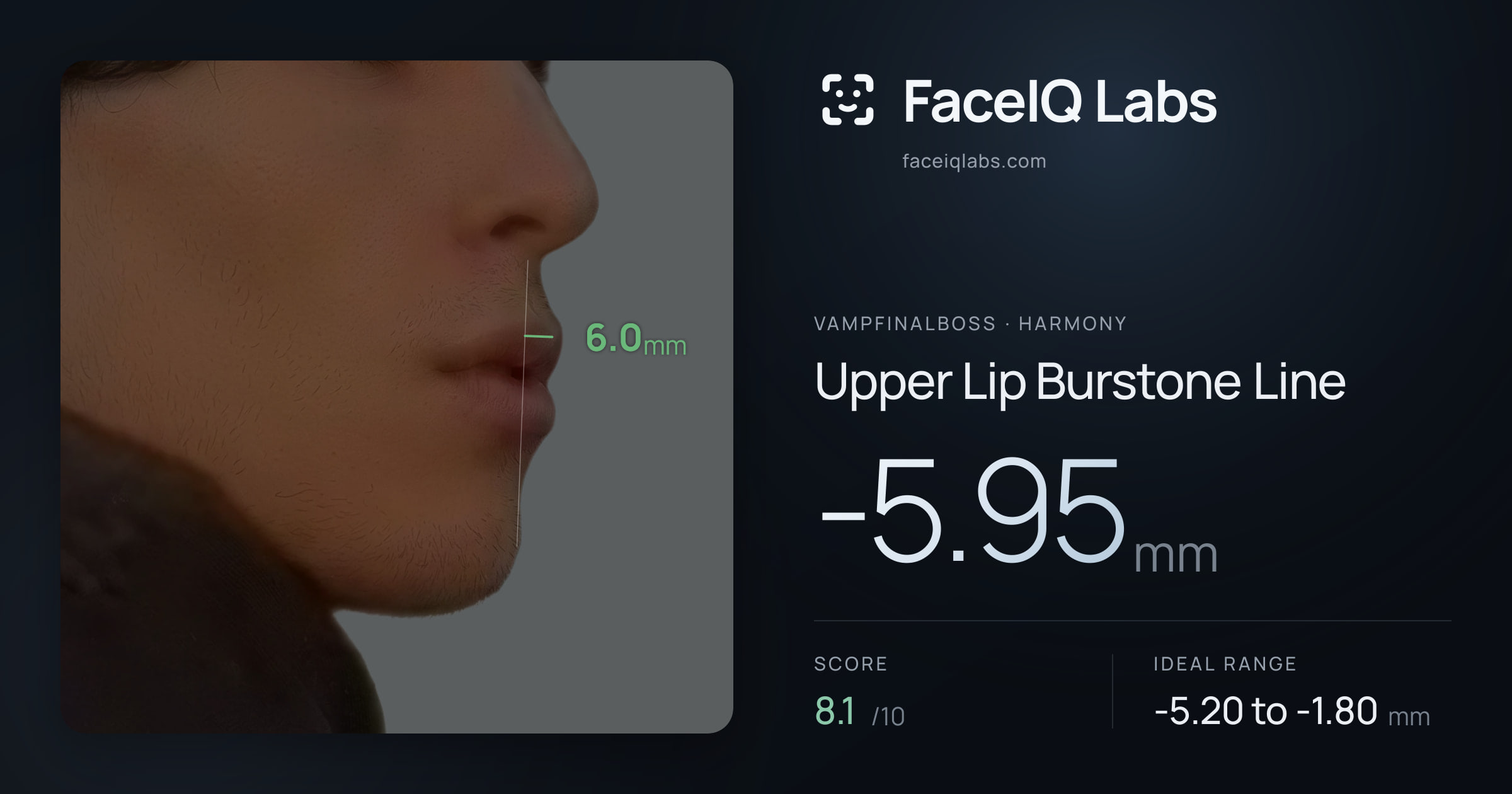 Vampfinalboss Upper Lip Burstone Line: -5.95mm, drawn on the photo