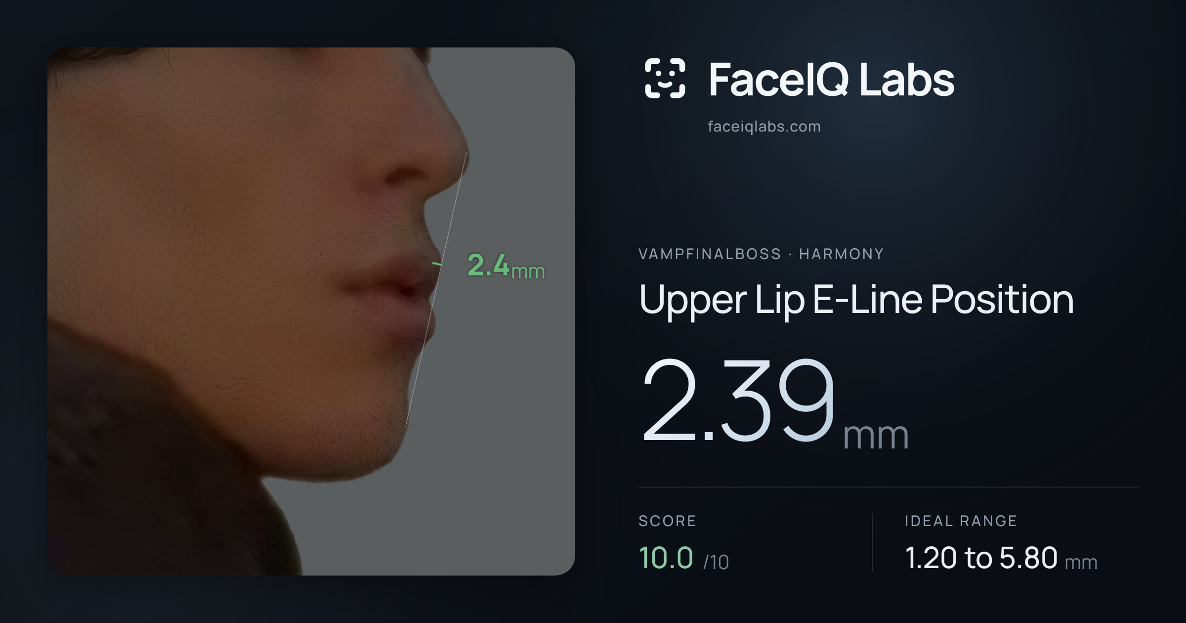 Vampfinalboss Upper Lip E-Line Position: 2.39mm, drawn on the photo