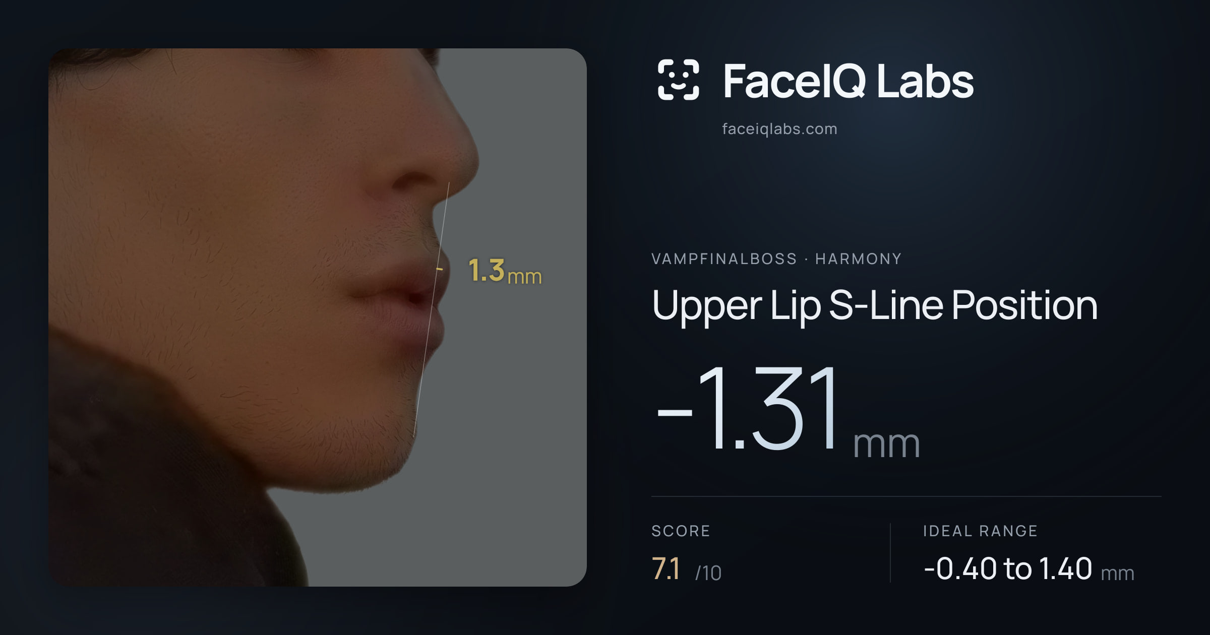 Vampfinalboss Upper Lip S-Line Position: -1.31mm, drawn on the photo