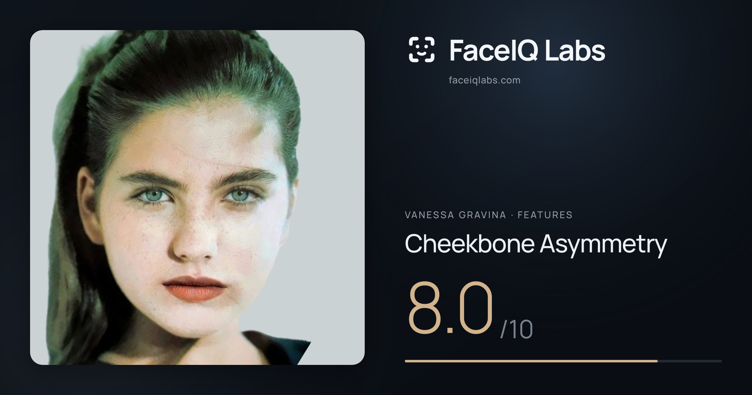 Vanessa Gravina Cheekbone Asymmetry: 8.0/10, drawn on the photo