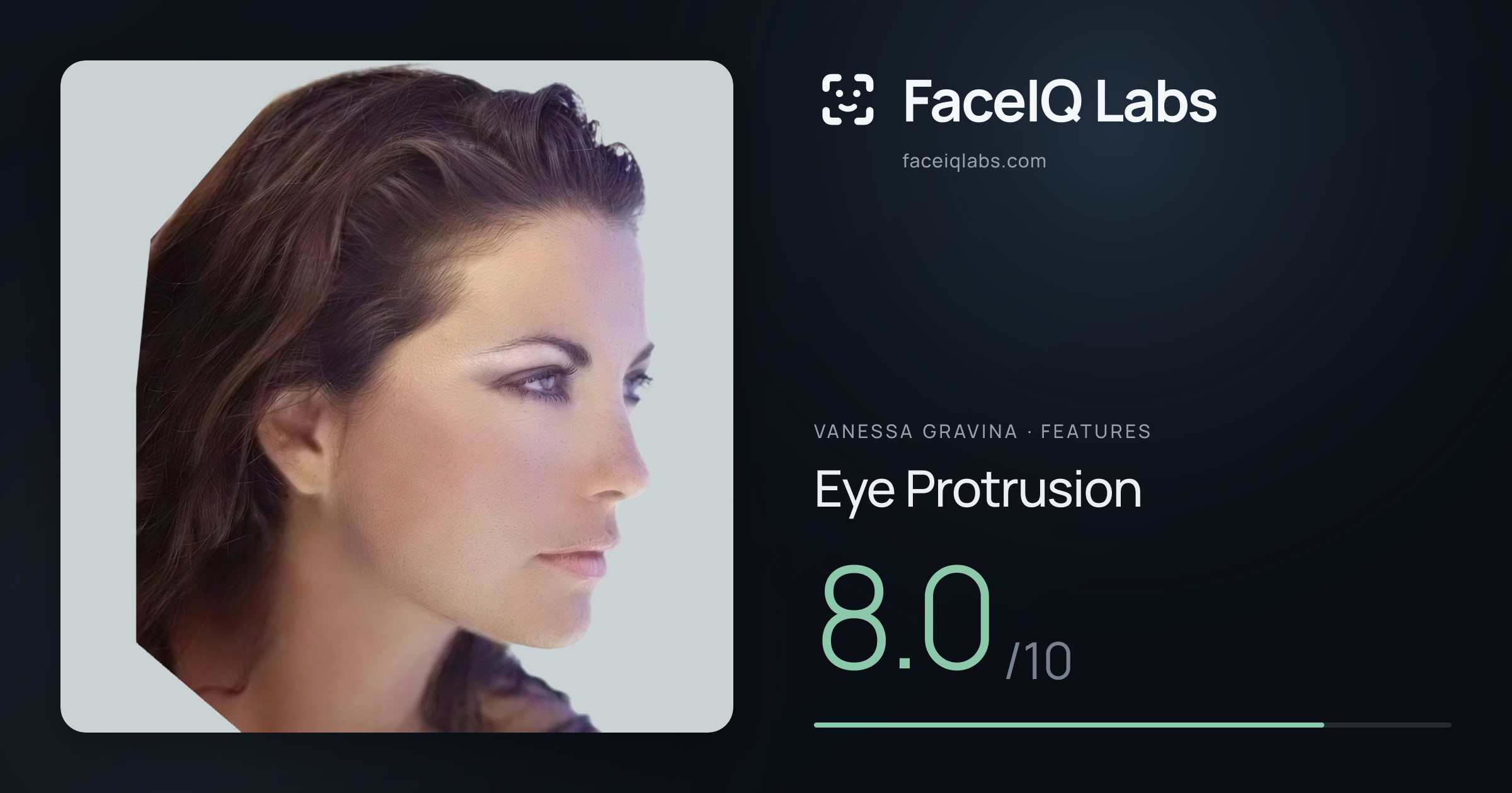 Vanessa Gravina Eye Protrusion: 8.0/10, drawn on the photo