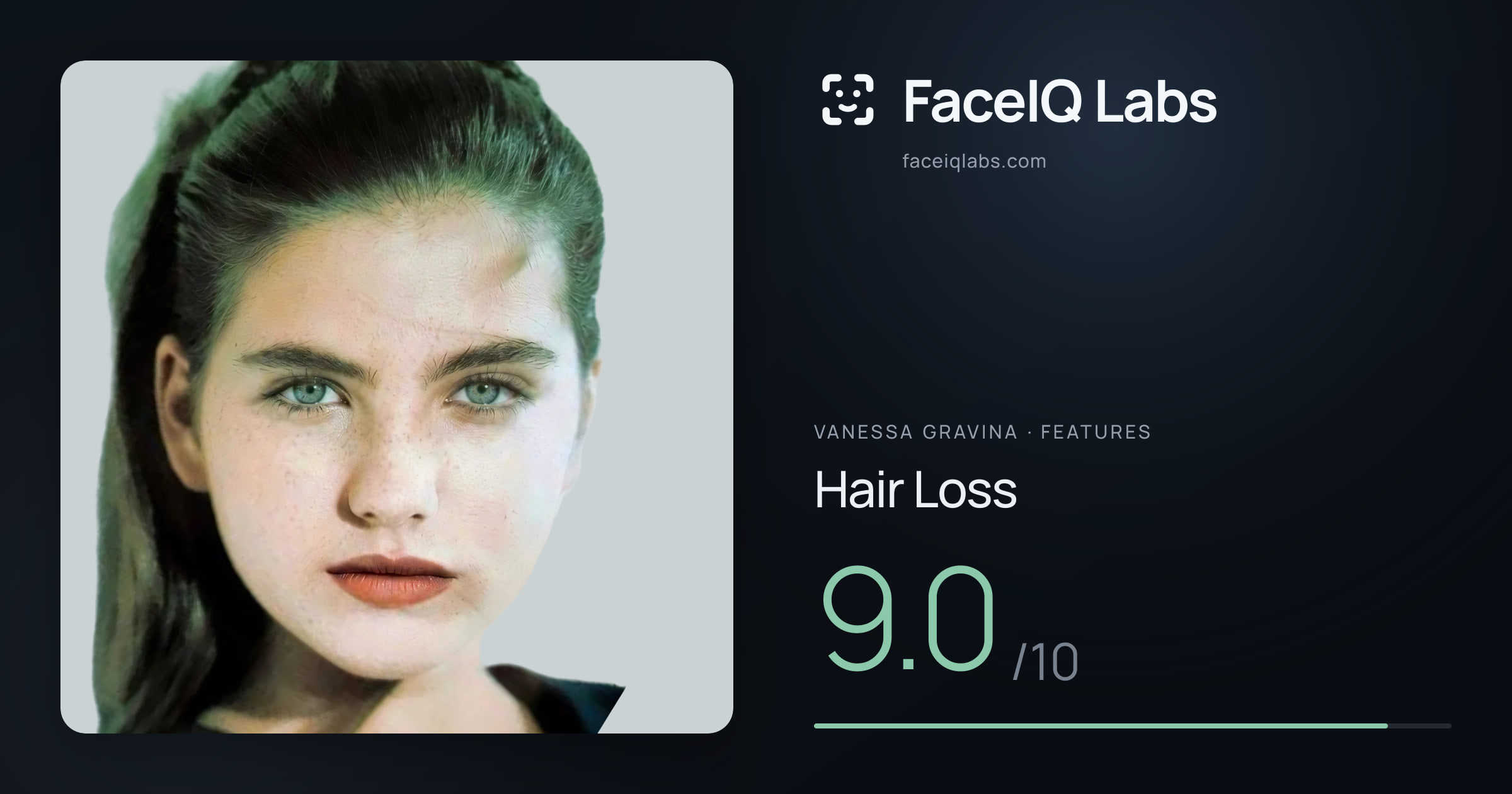 Vanessa Gravina Hair Loss: 9.0/10, drawn on the photo
