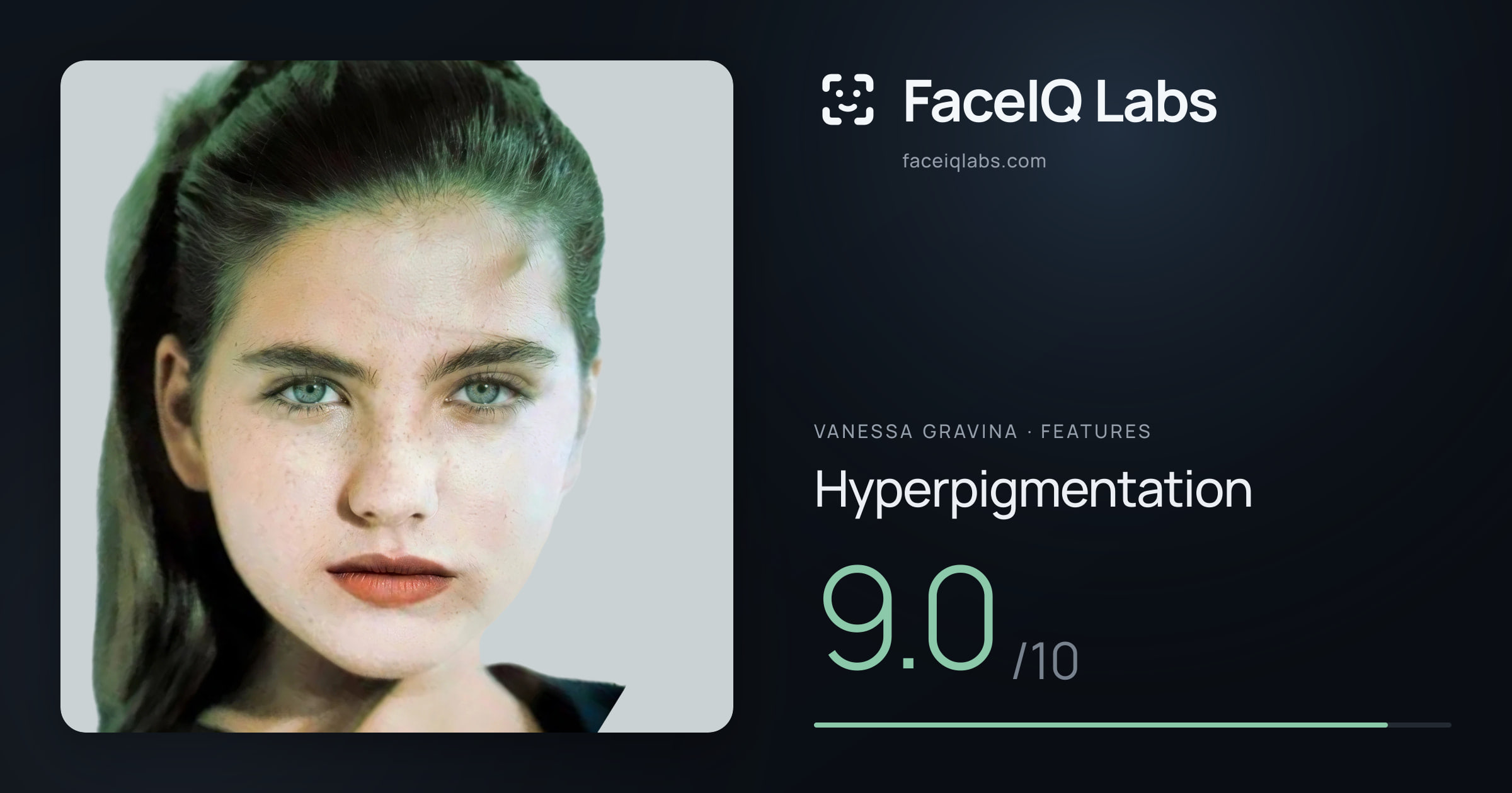 Vanessa Gravina Hyperpigmentation: 9.0/10, drawn on the photo