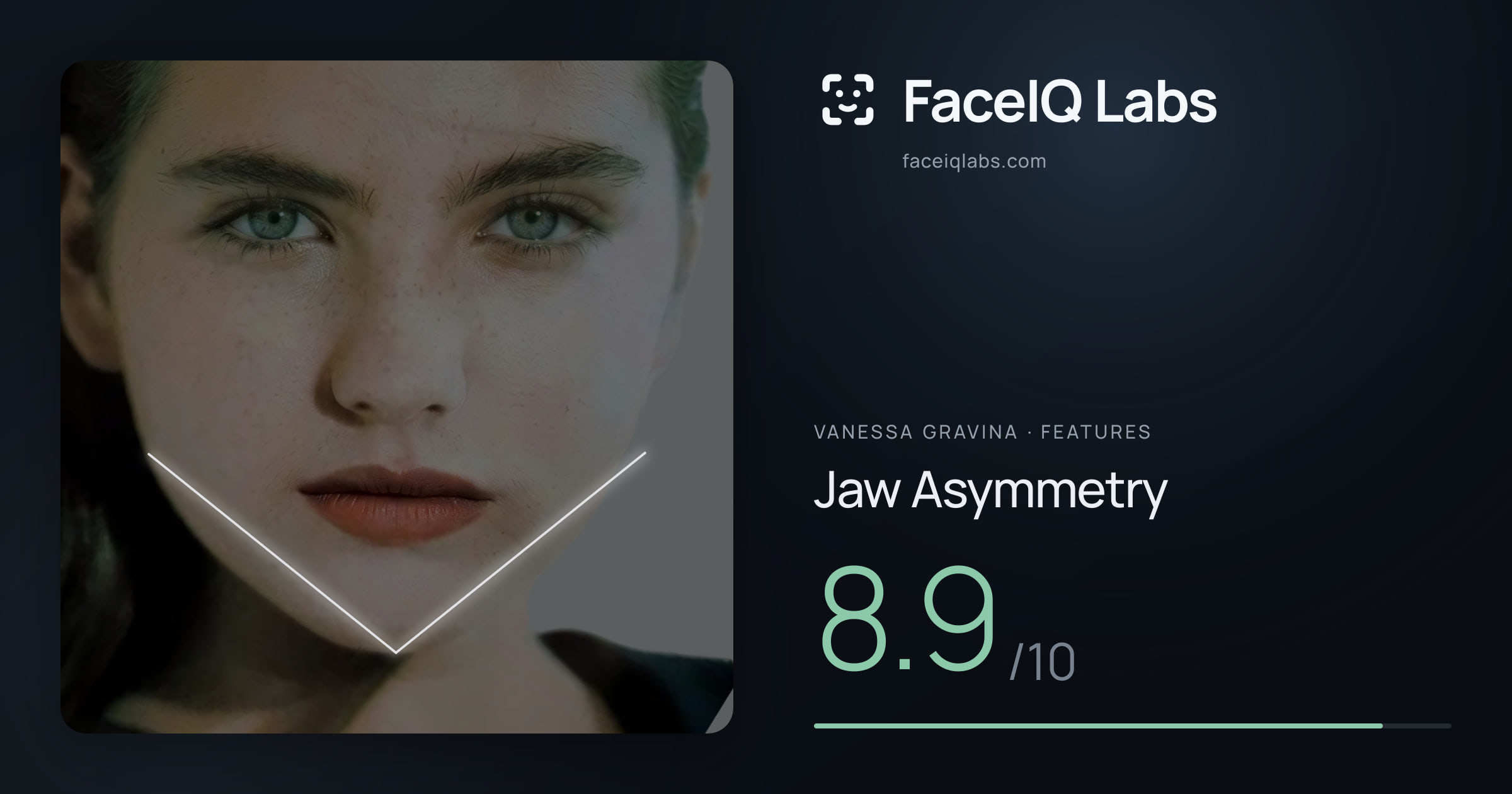 Vanessa Gravina Jaw Asymmetry: 8.9/10, drawn on the photo