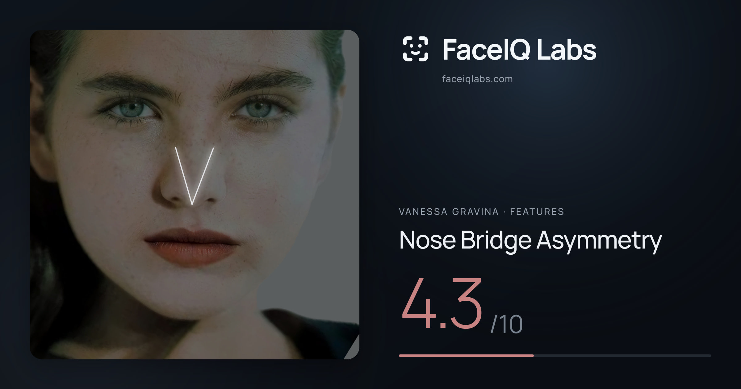 Vanessa Gravina Nose Bridge Asymmetry: 4.3/10, drawn on the photo