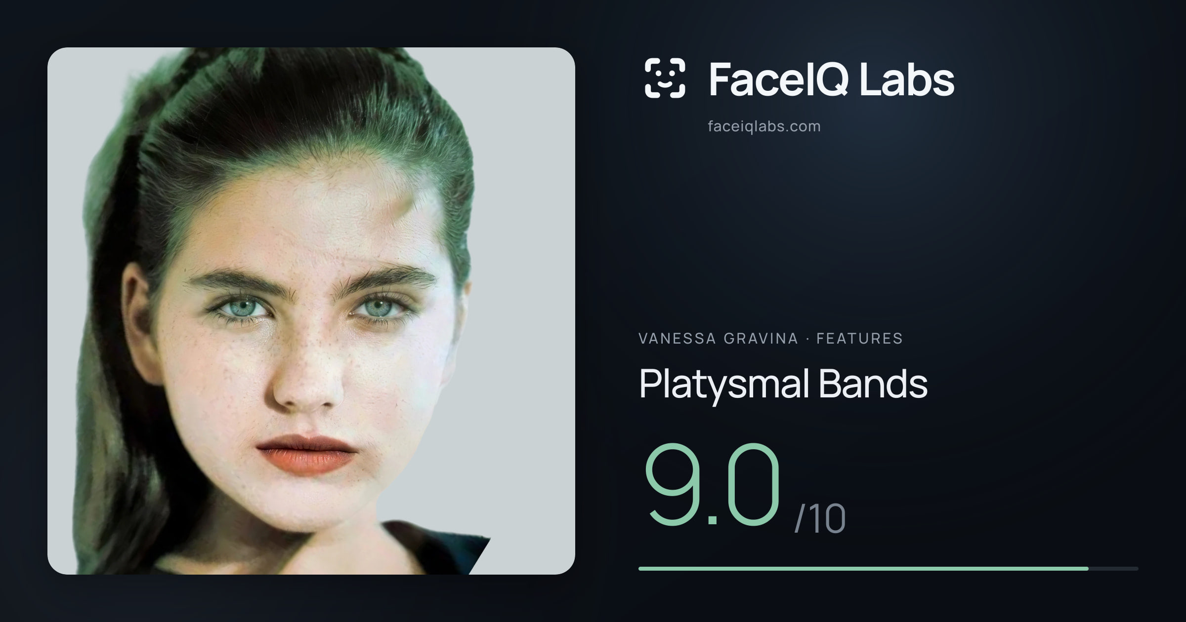 Vanessa Gravina Platysmal Bands: 9.0/10, drawn on the photo
