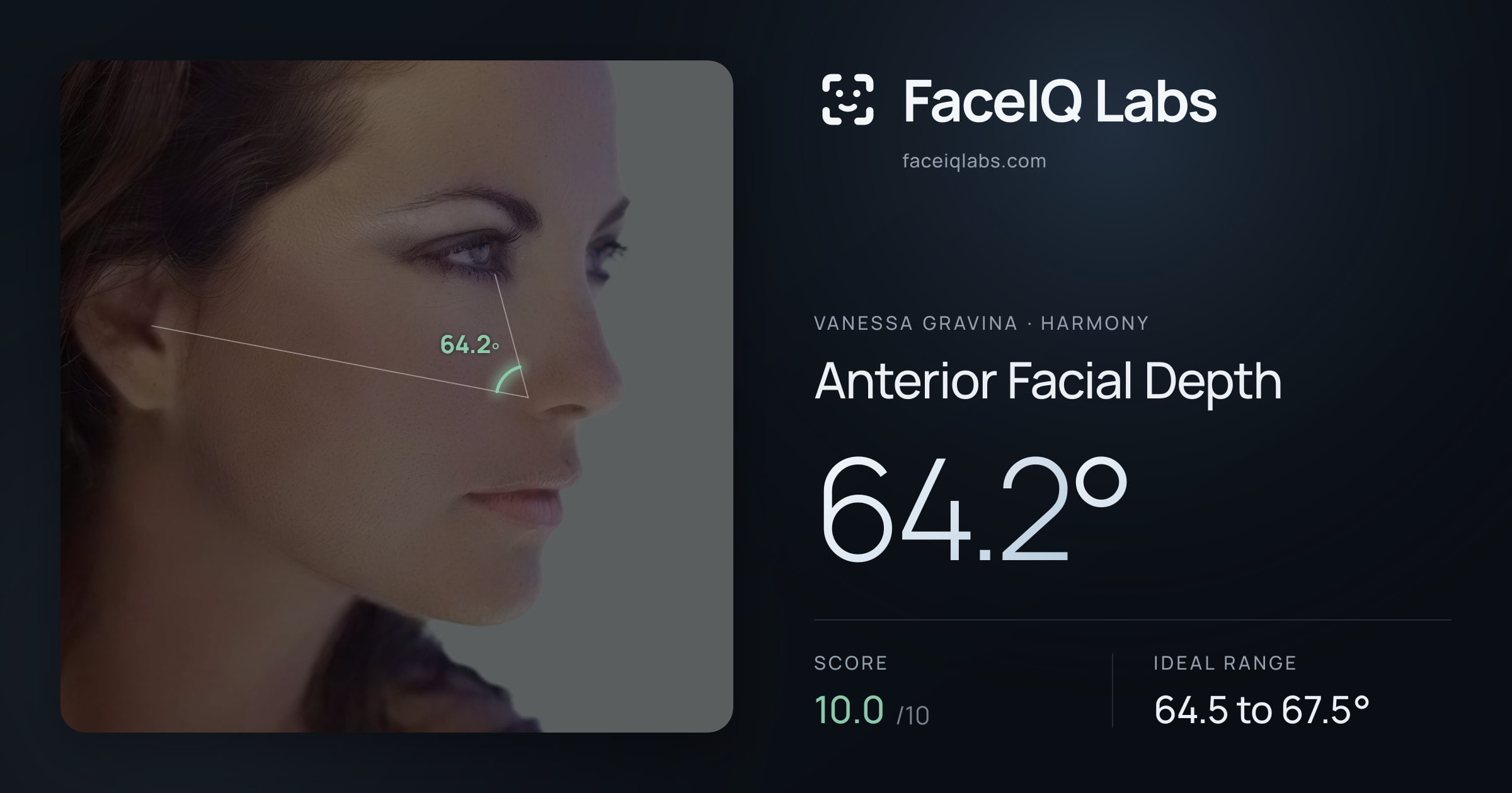 Vanessa Gravina Anterior Facial Depth: 64.2°, drawn on the photo
