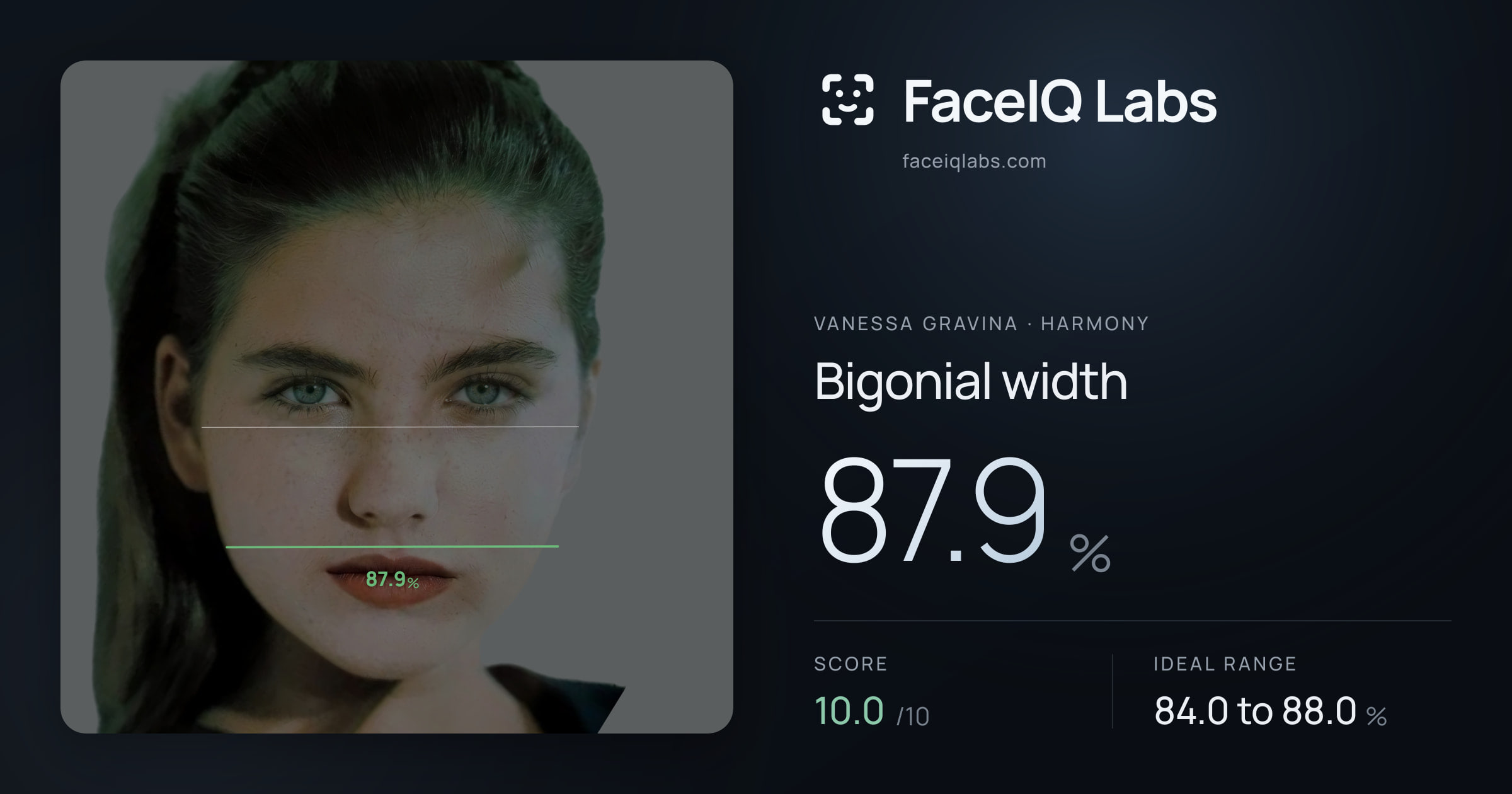 Vanessa Gravina Bigonial width: 87.9%, drawn on the photo