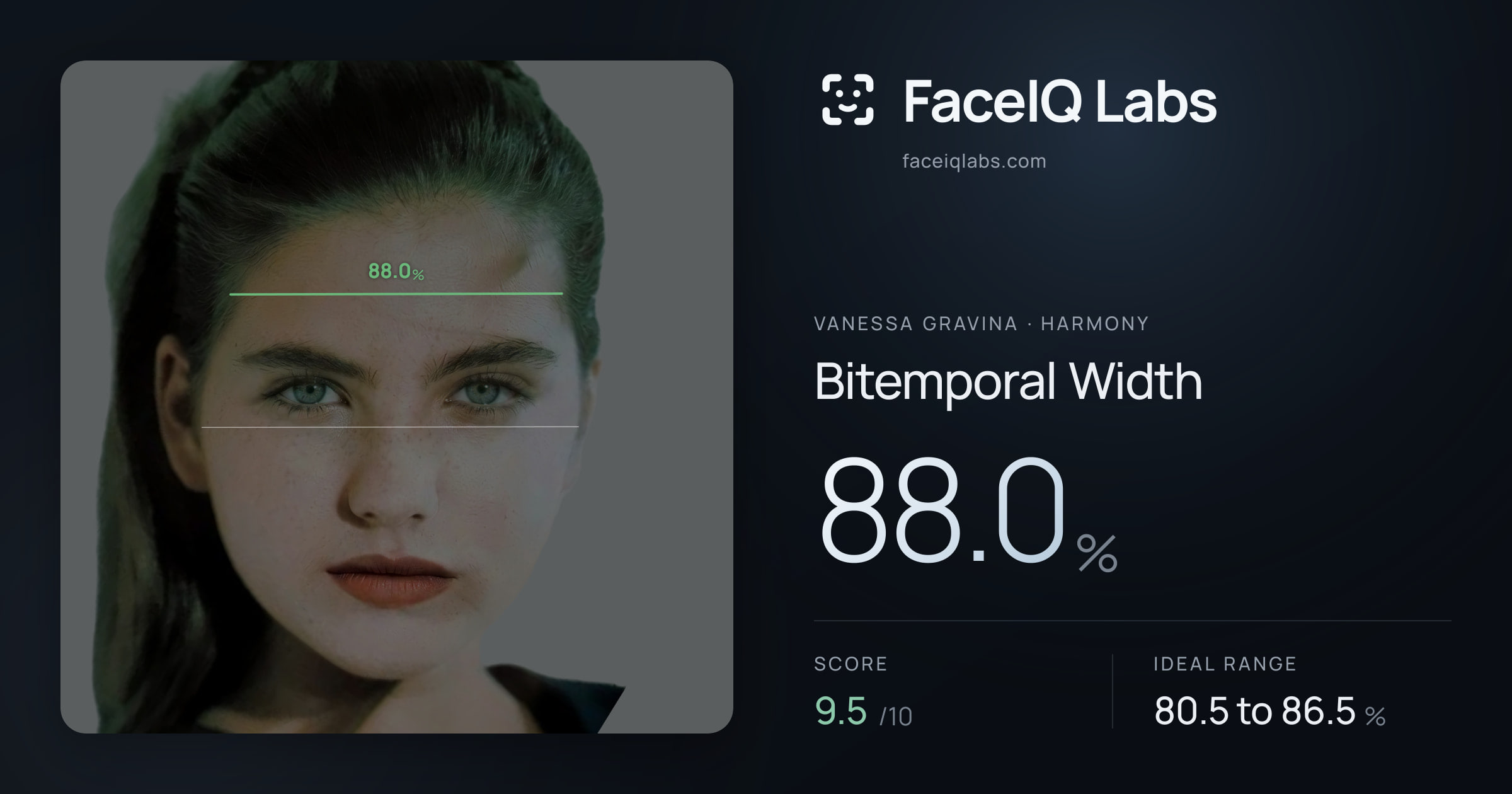 Vanessa Gravina Bitemporal Width: 88.0%, drawn on the photo