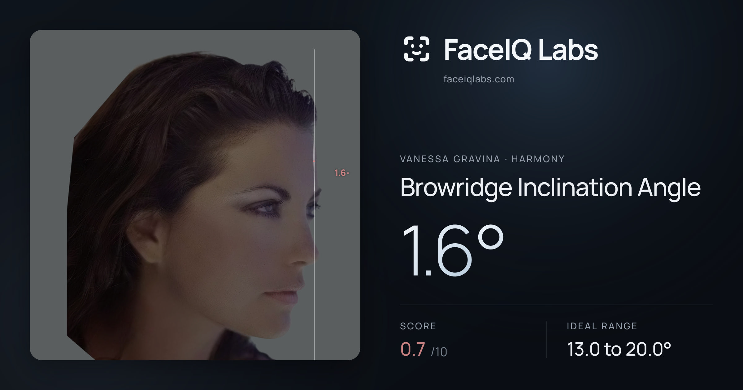 Vanessa Gravina Browridge Inclination Angle: 1.6°, drawn on the photo