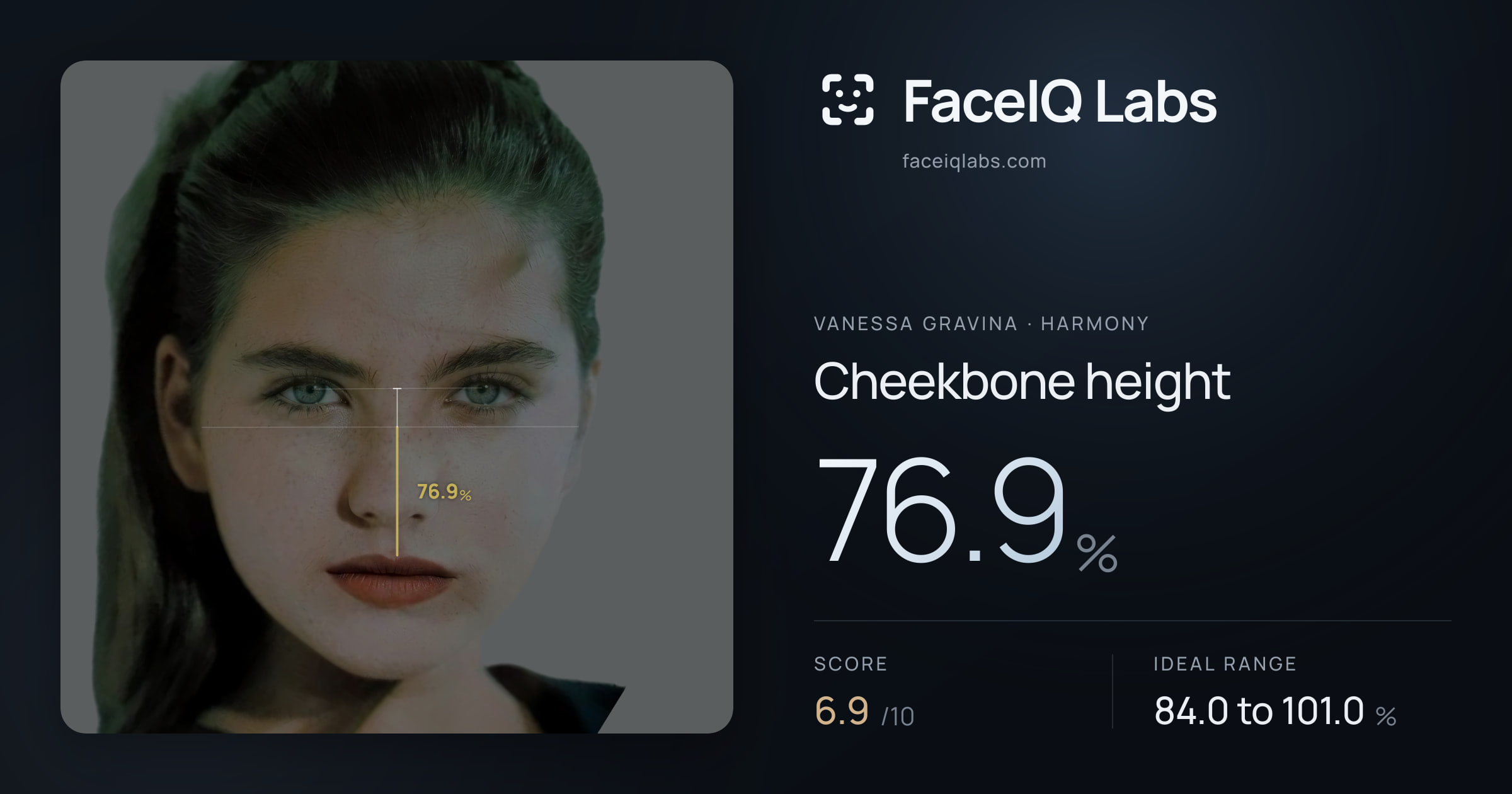 Vanessa Gravina Cheekbone height: 76.9%, drawn on the photo