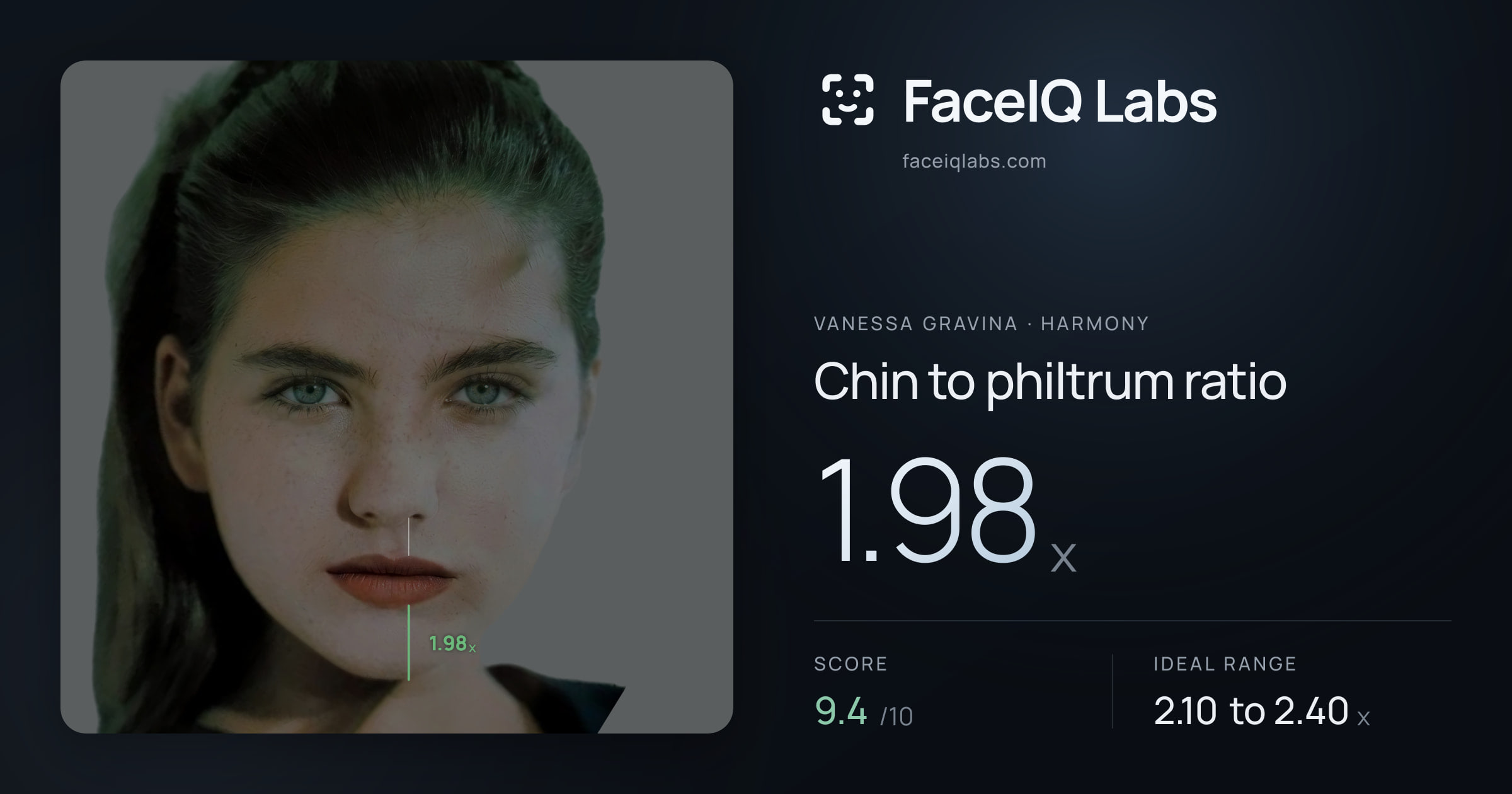 Vanessa Gravina Chin to philtrum ratio: 1.98x, drawn on the photo
