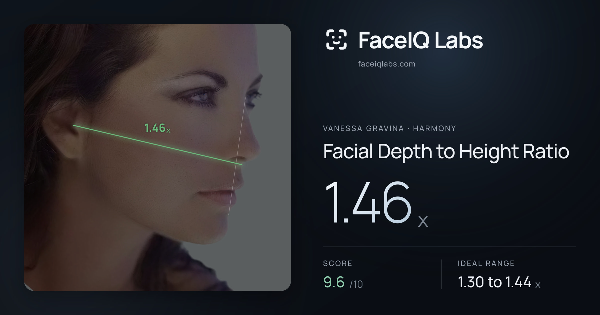 Vanessa Gravina Facial Depth to Height Ratio: 1.46x, drawn on the photo