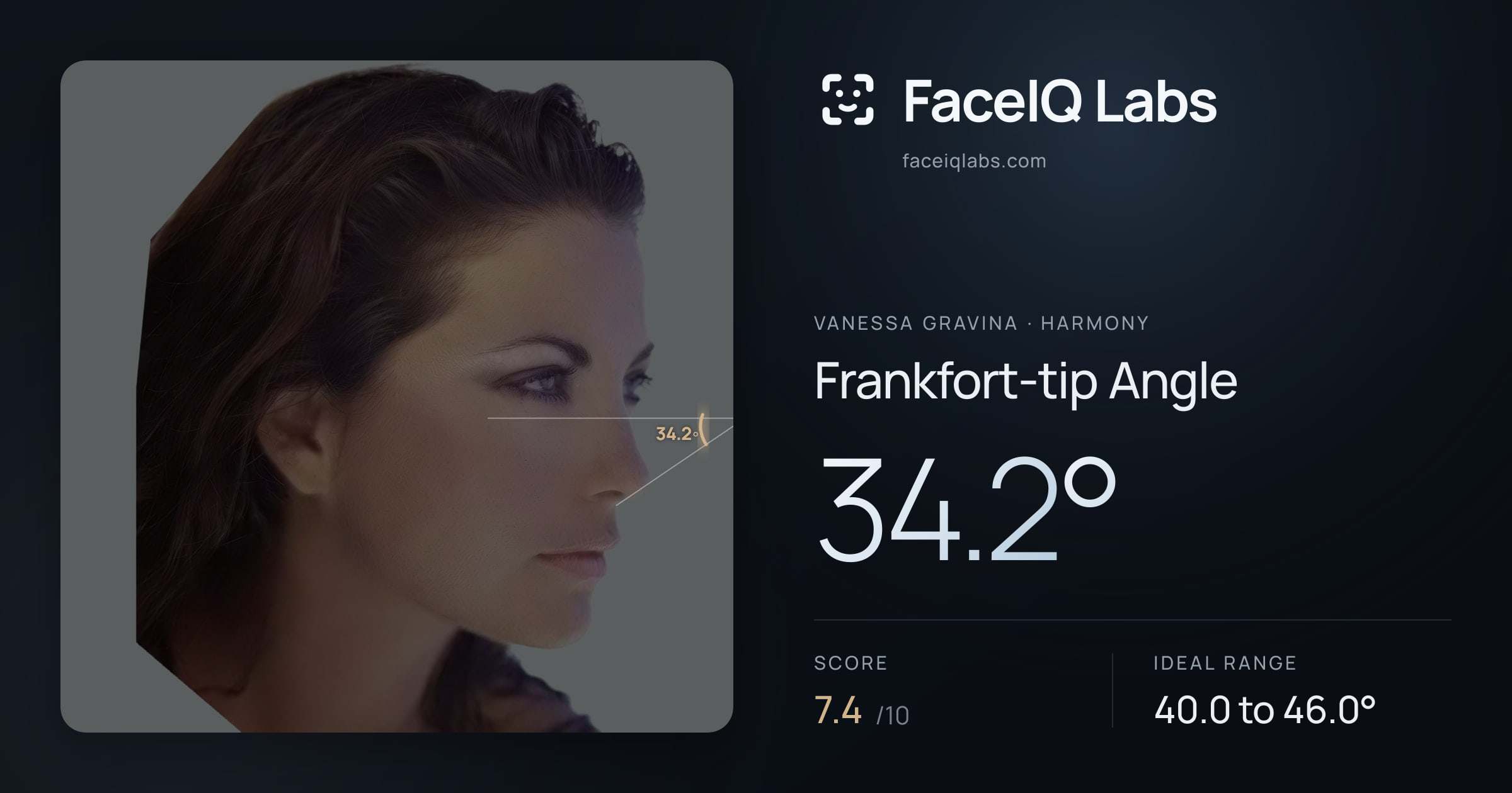Vanessa Gravina Frankfort-tip Angle: 34.2°, drawn on the photo