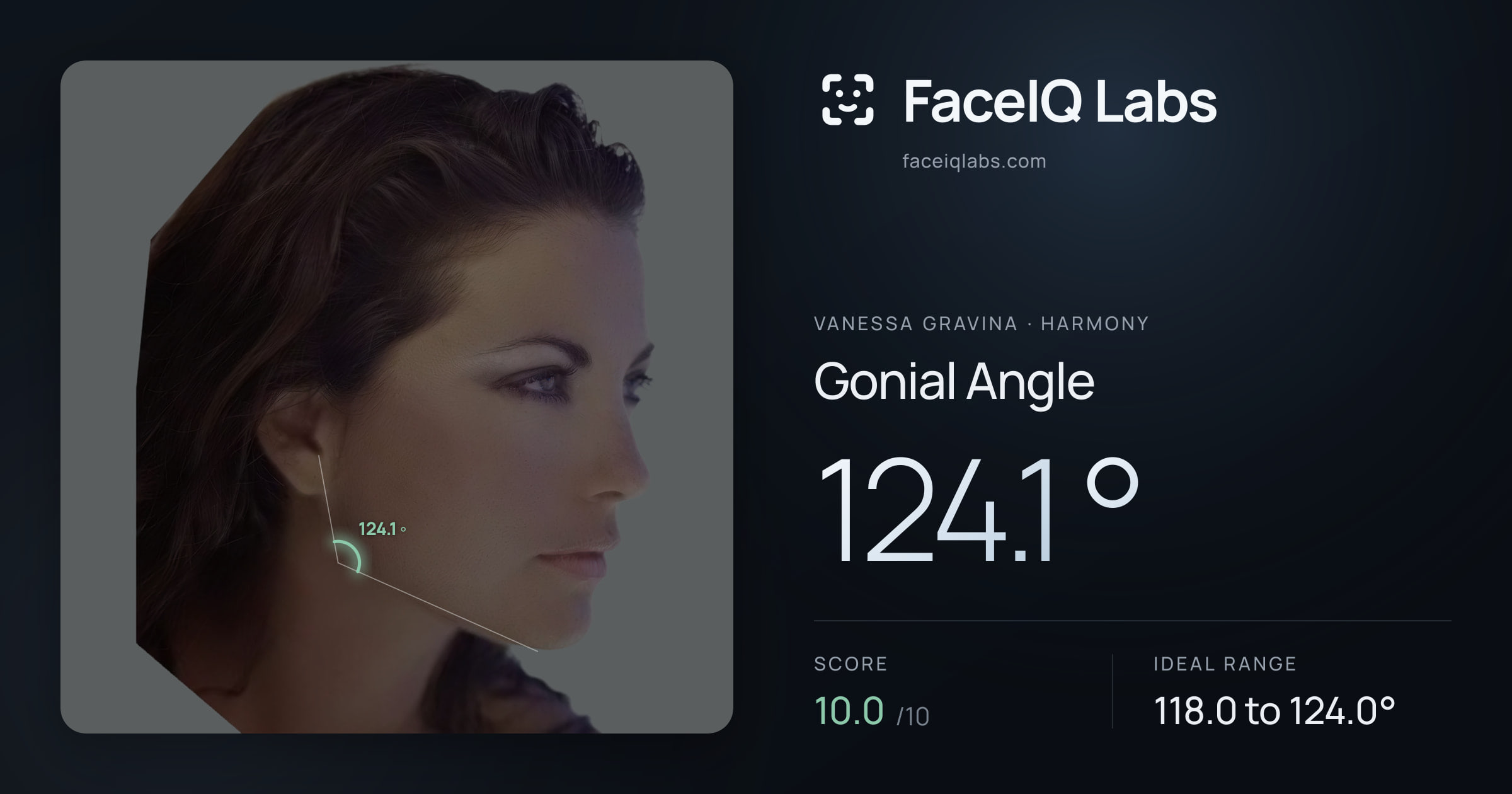 Vanessa Gravina Gonial Angle: 124.1°, drawn on the photo