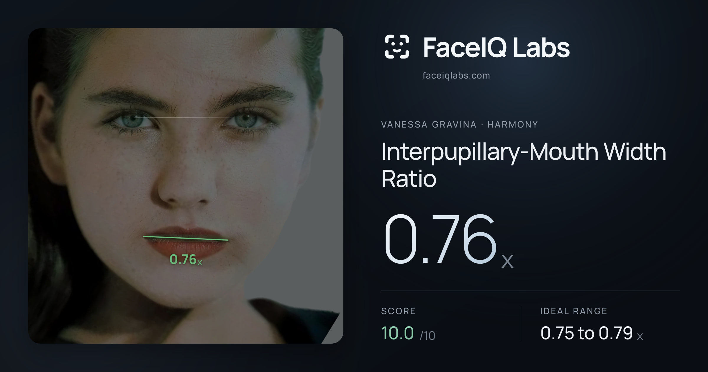 Vanessa Gravina Interpupillary-Mouth Width Ratio: 0.76x, drawn on the photo