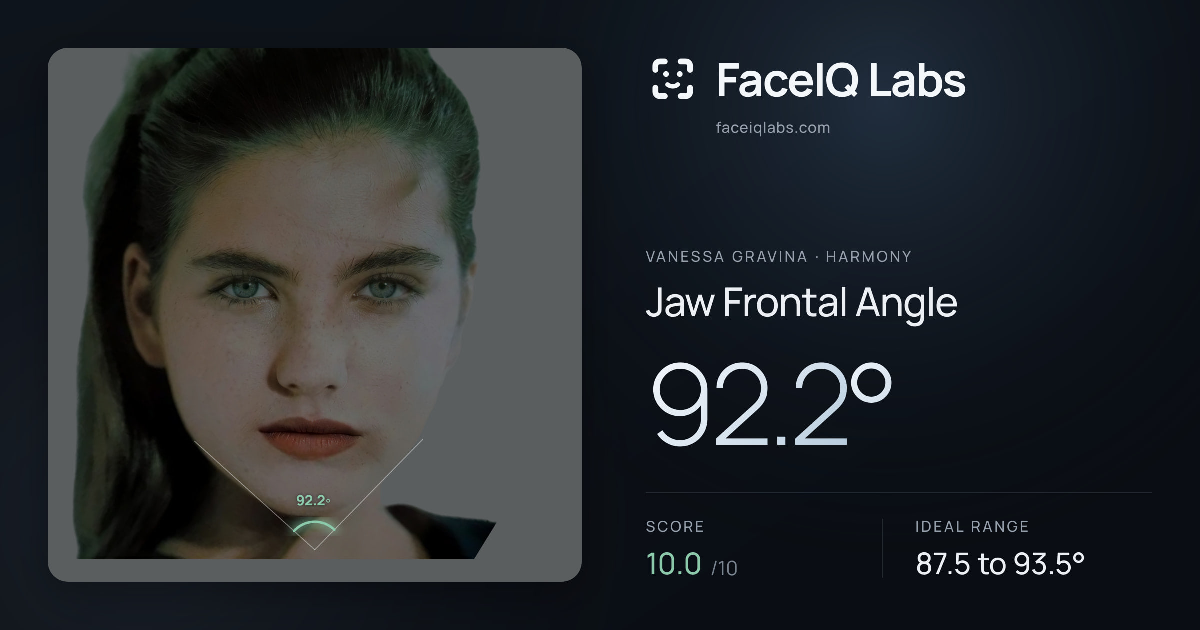 Vanessa Gravina Jaw Frontal Angle: 92.2°, drawn on the photo