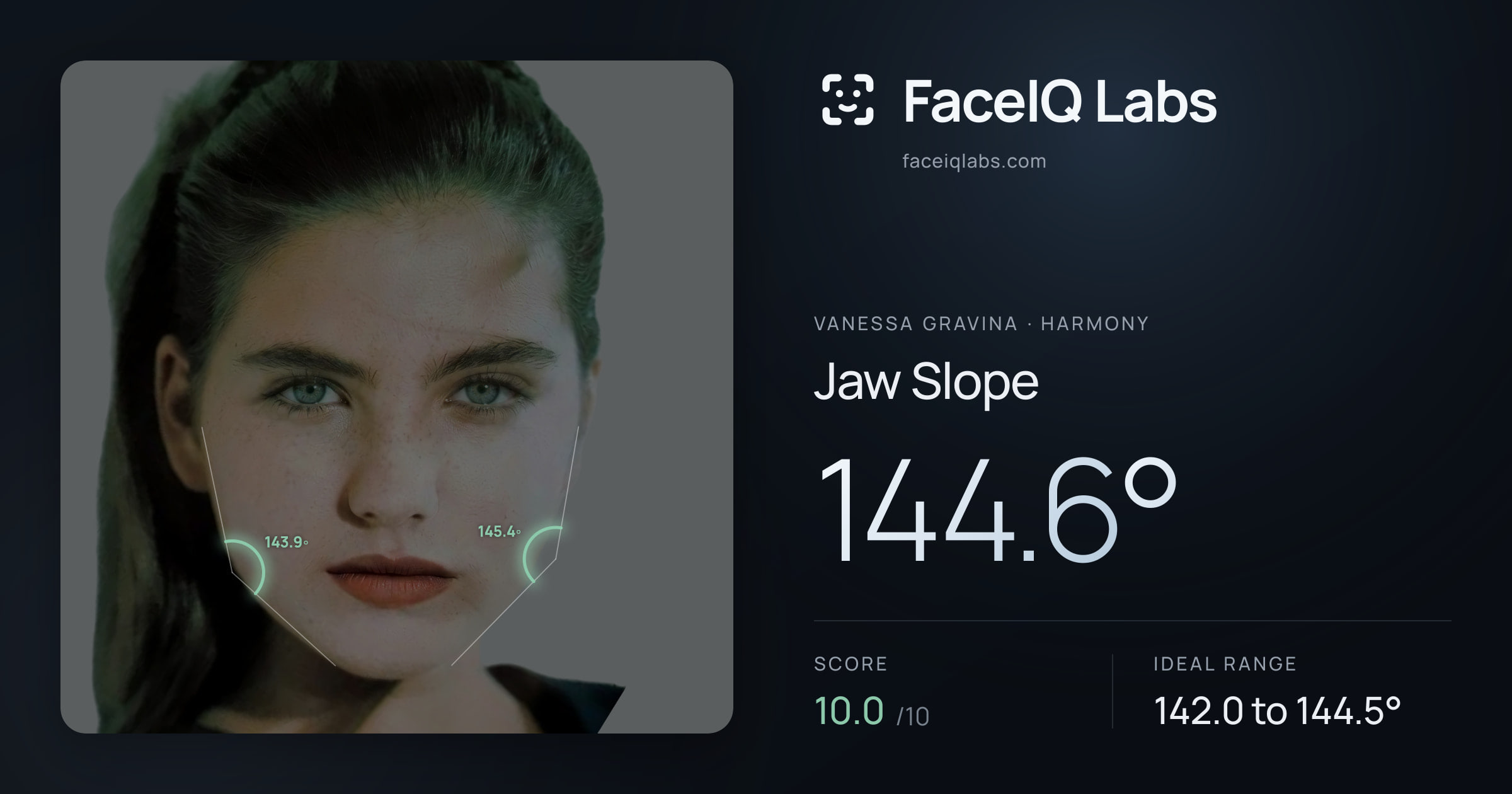 Vanessa Gravina Jaw Slope: 144.6°, drawn on the photo