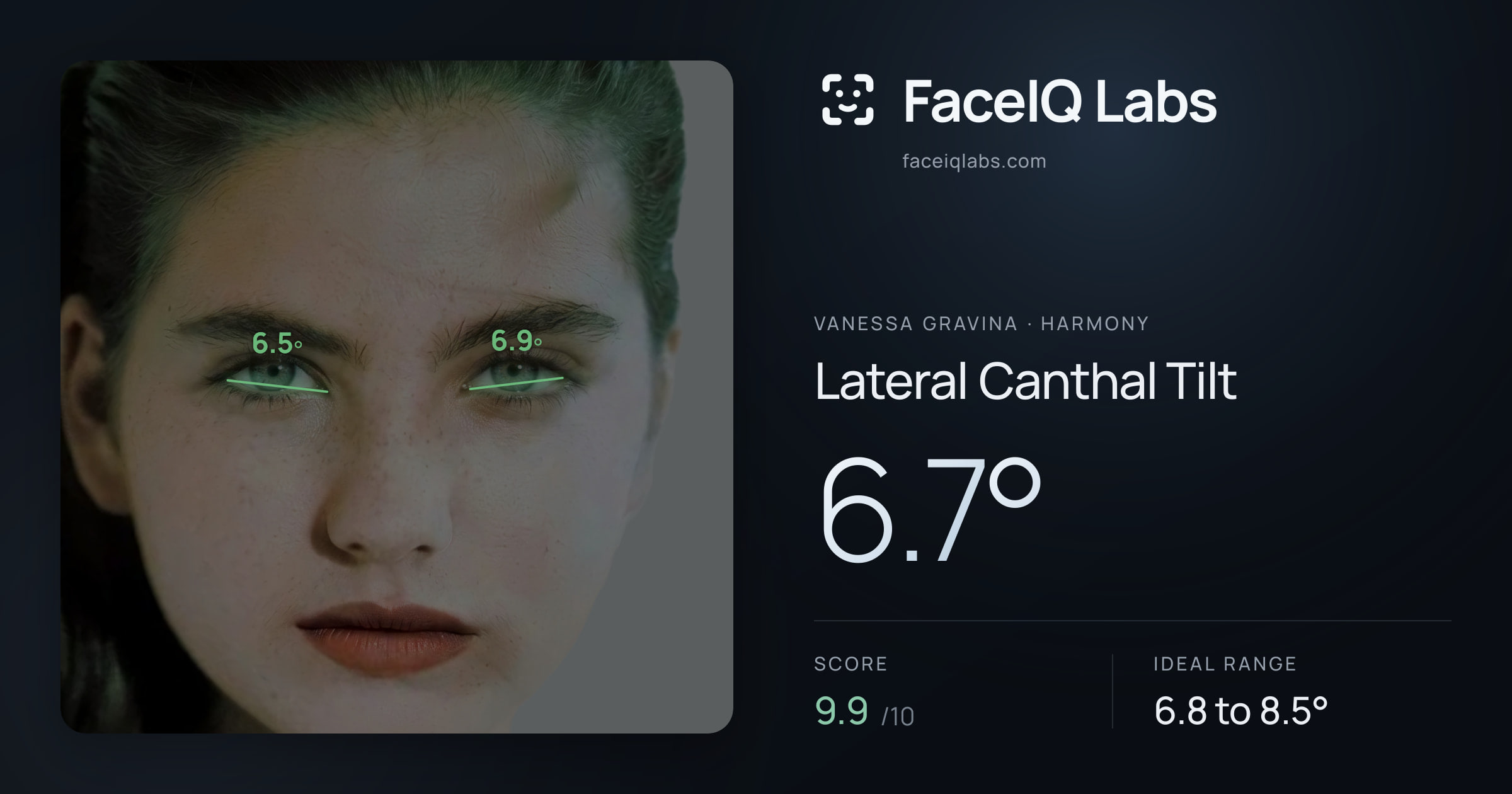 Vanessa Gravina Lateral Canthal Tilt: 6.7°, drawn on the photo
