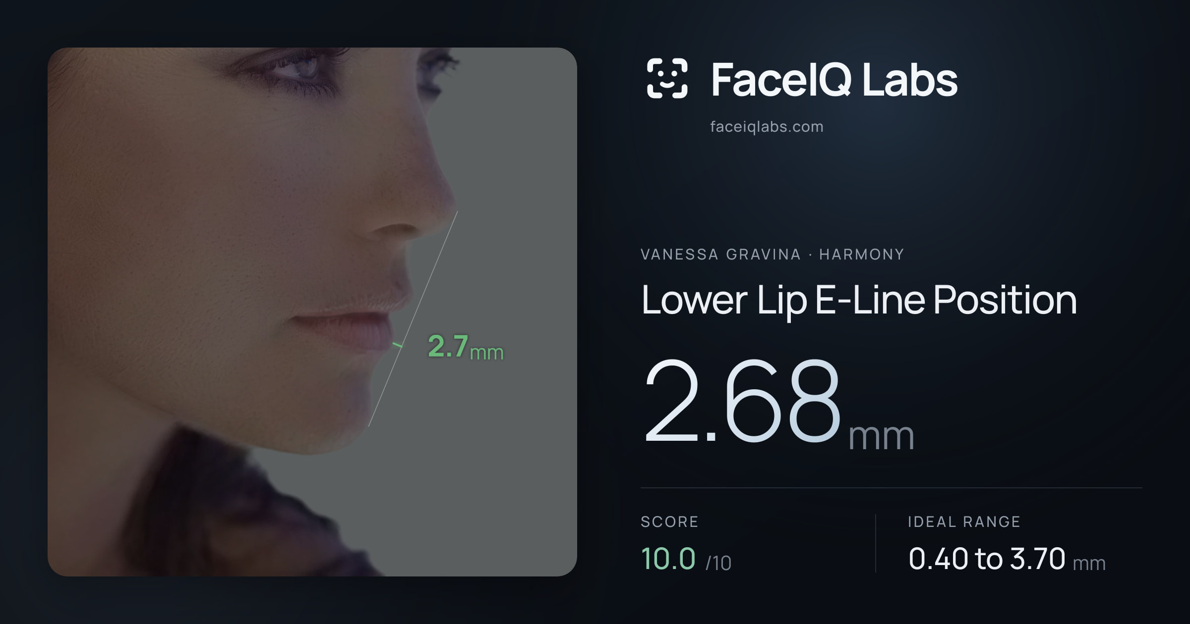 Vanessa Gravina Lower Lip E-Line Position: 2.68mm, drawn on the photo