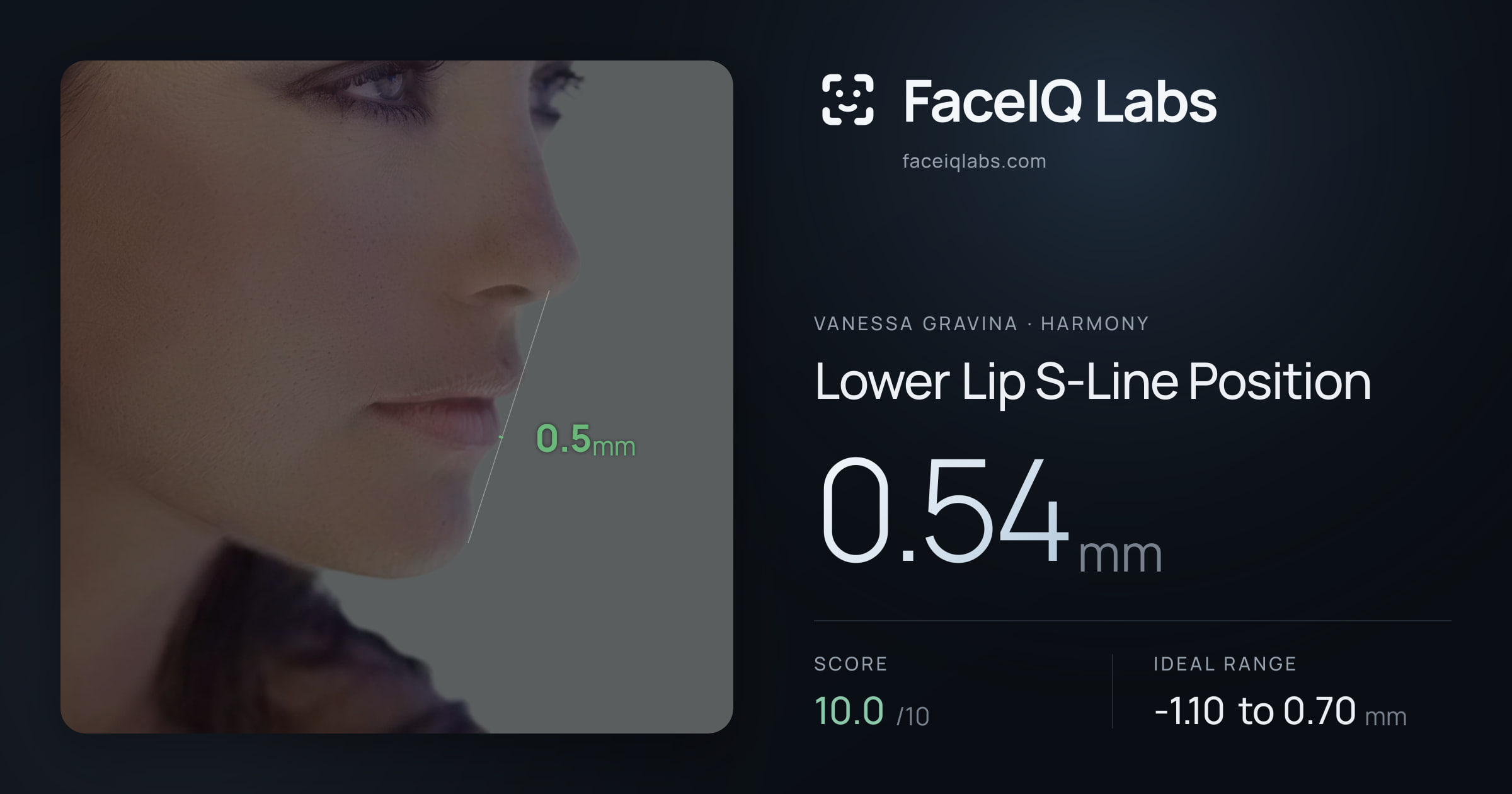 Vanessa Gravina Lower Lip S-Line Position: 0.54mm, drawn on the photo