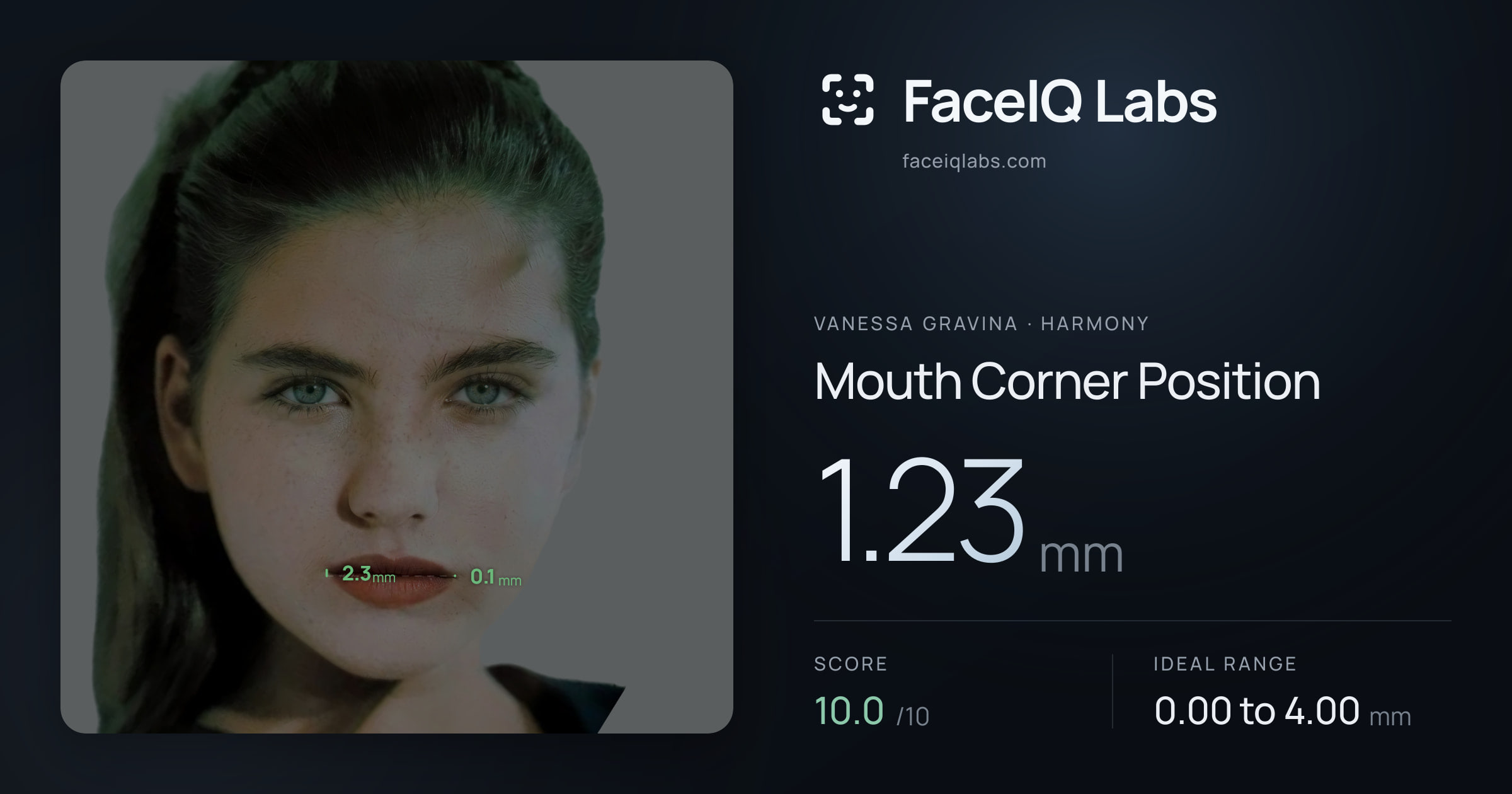 Vanessa Gravina Mouth Corner Position: 1.23mm, drawn on the photo