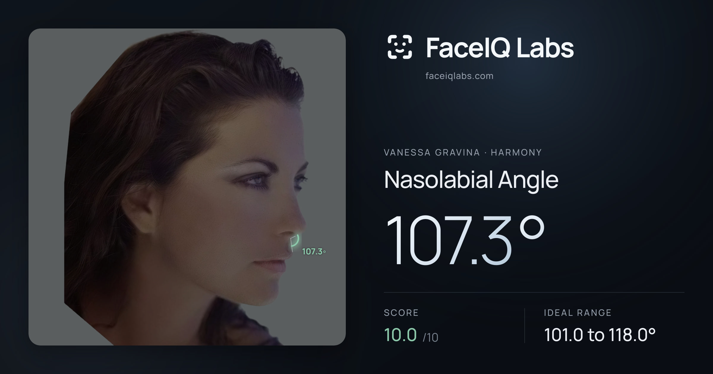 Vanessa Gravina Nasolabial Angle: 107.3°, drawn on the photo