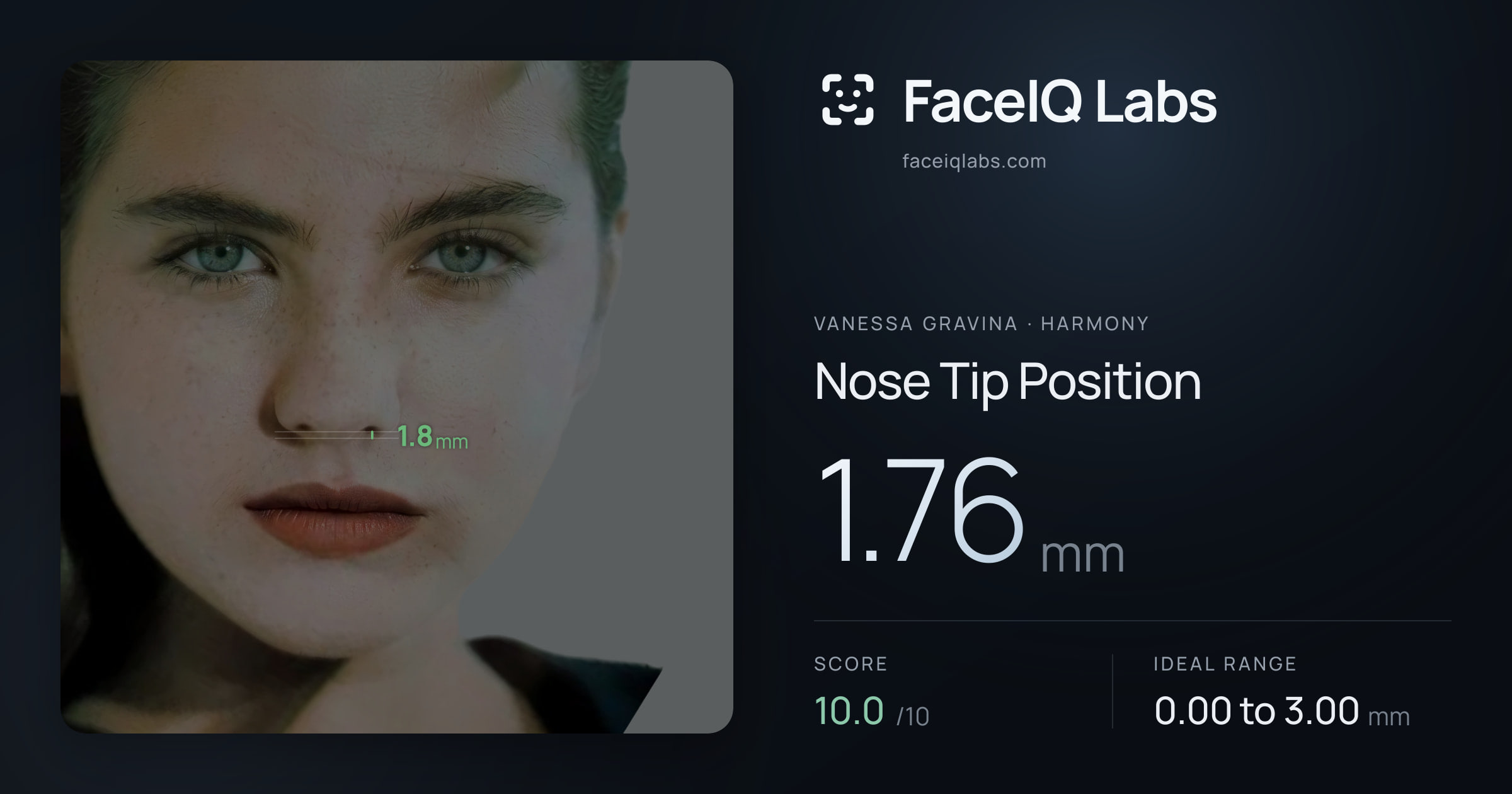 Vanessa Gravina Nose Tip Position: 1.76mm, drawn on the photo