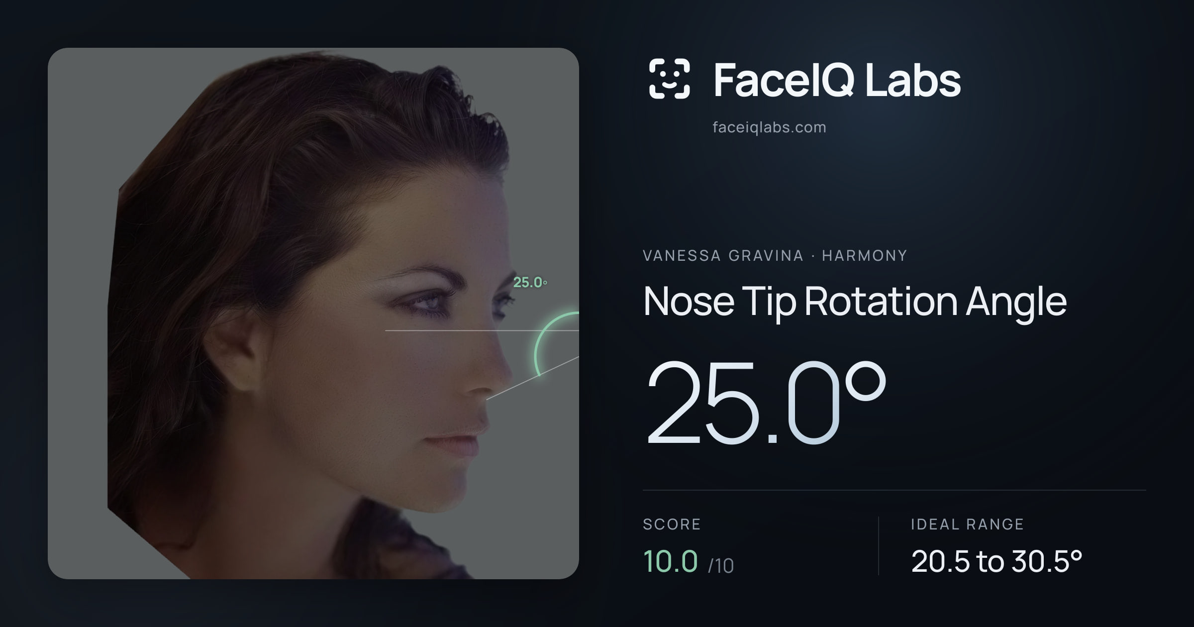 Vanessa Gravina Nose Tip Rotation Angle: 25.0°, drawn on the photo