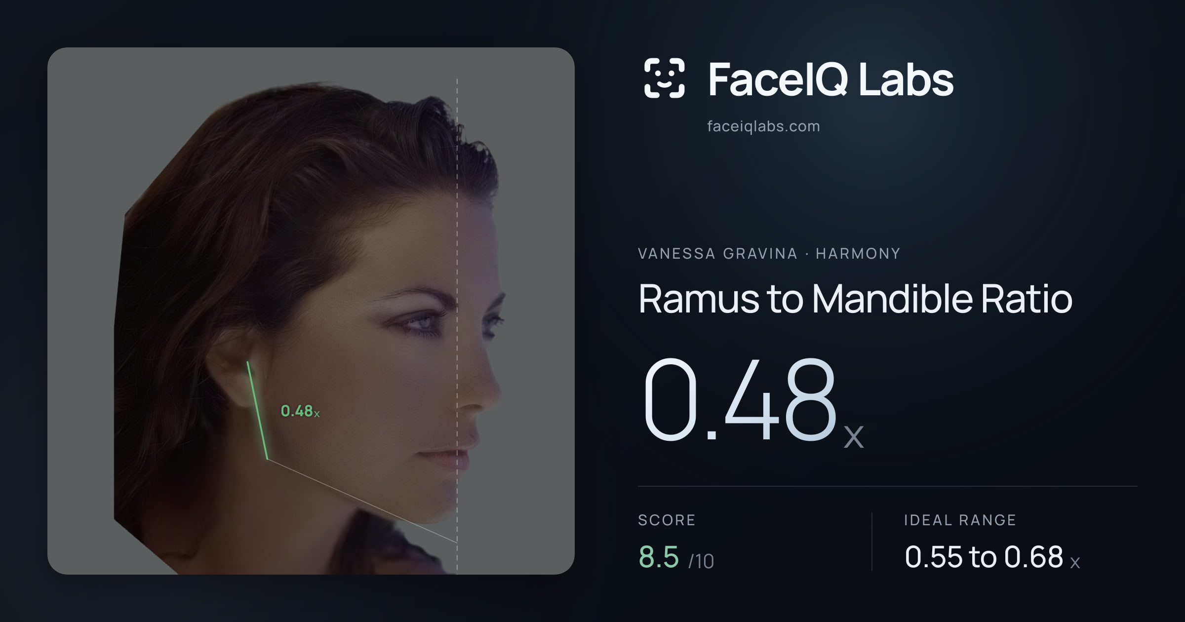 Vanessa Gravina Ramus to Mandible Ratio: 0.48x, drawn on the photo