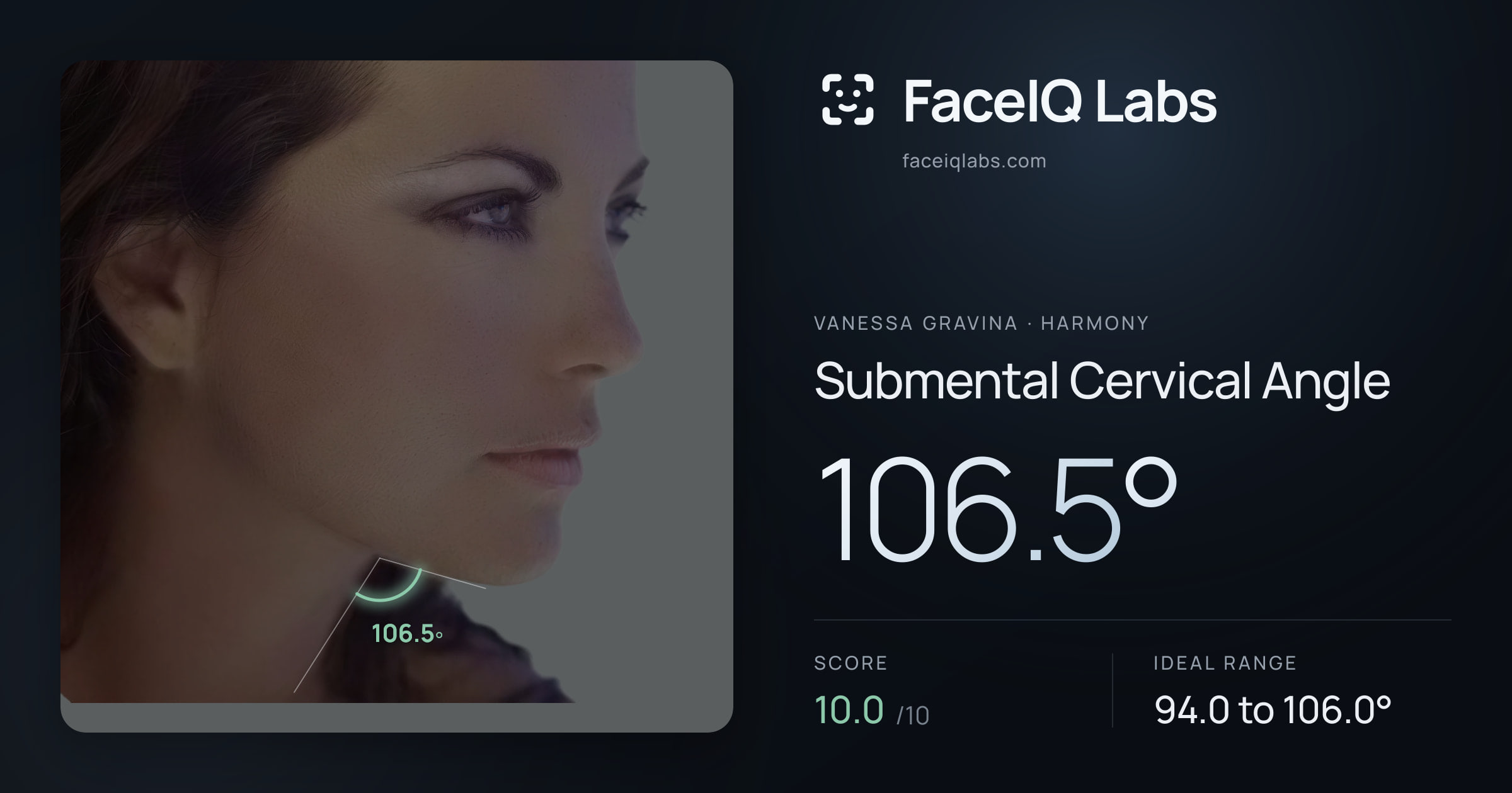 Vanessa Gravina Submental Cervical Angle: 106.5°, drawn on the photo
