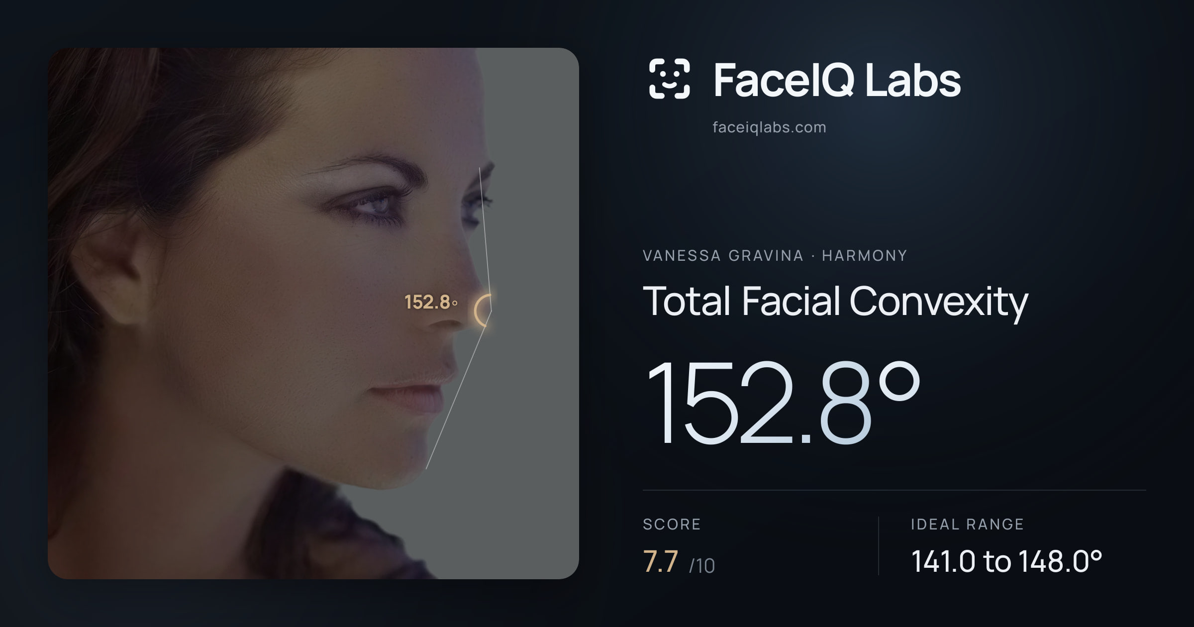 Vanessa Gravina Total Facial Convexity: 152.8°, drawn on the photo