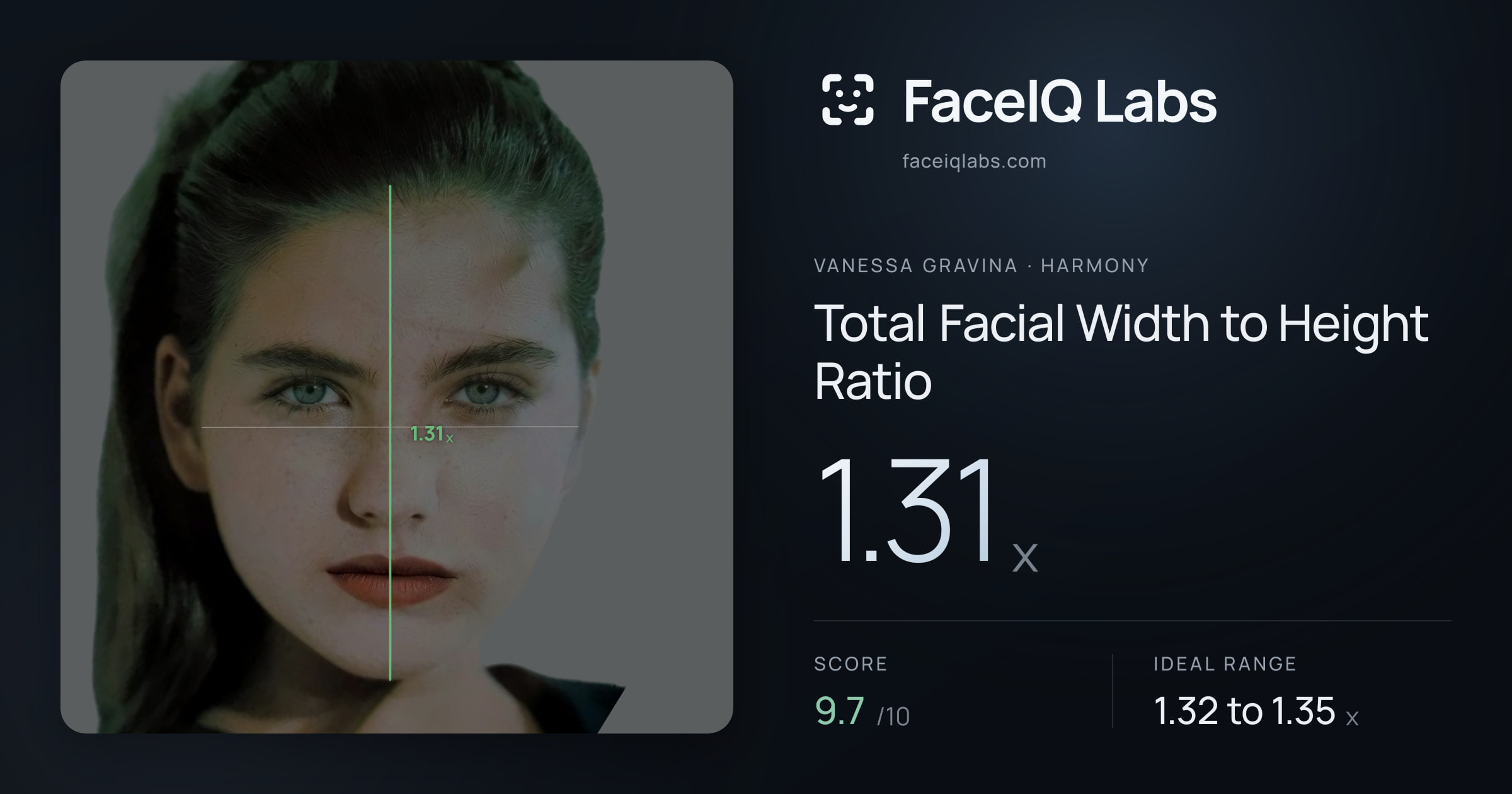 Vanessa Gravina Total Facial Width to Height Ratio: 1.31x, drawn on the photo